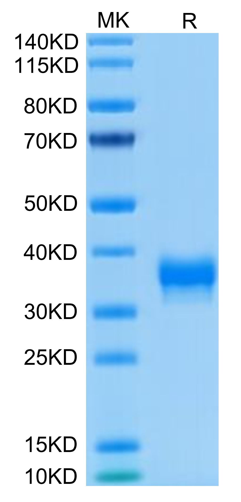 Human BTN1A1/Butyrophilin Protein (BTN-HM4A1)