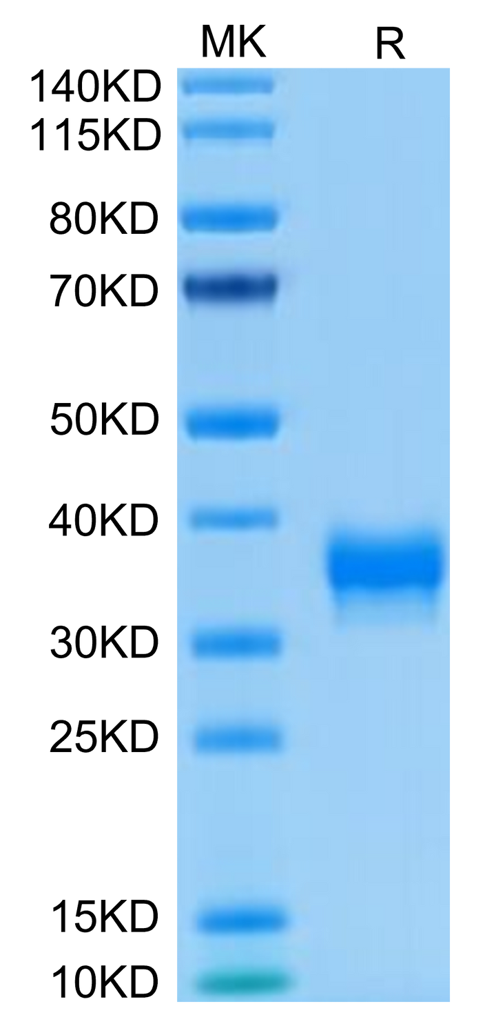 Human BTN1A1/Butyrophilin Protein (BTN-HM4A1)