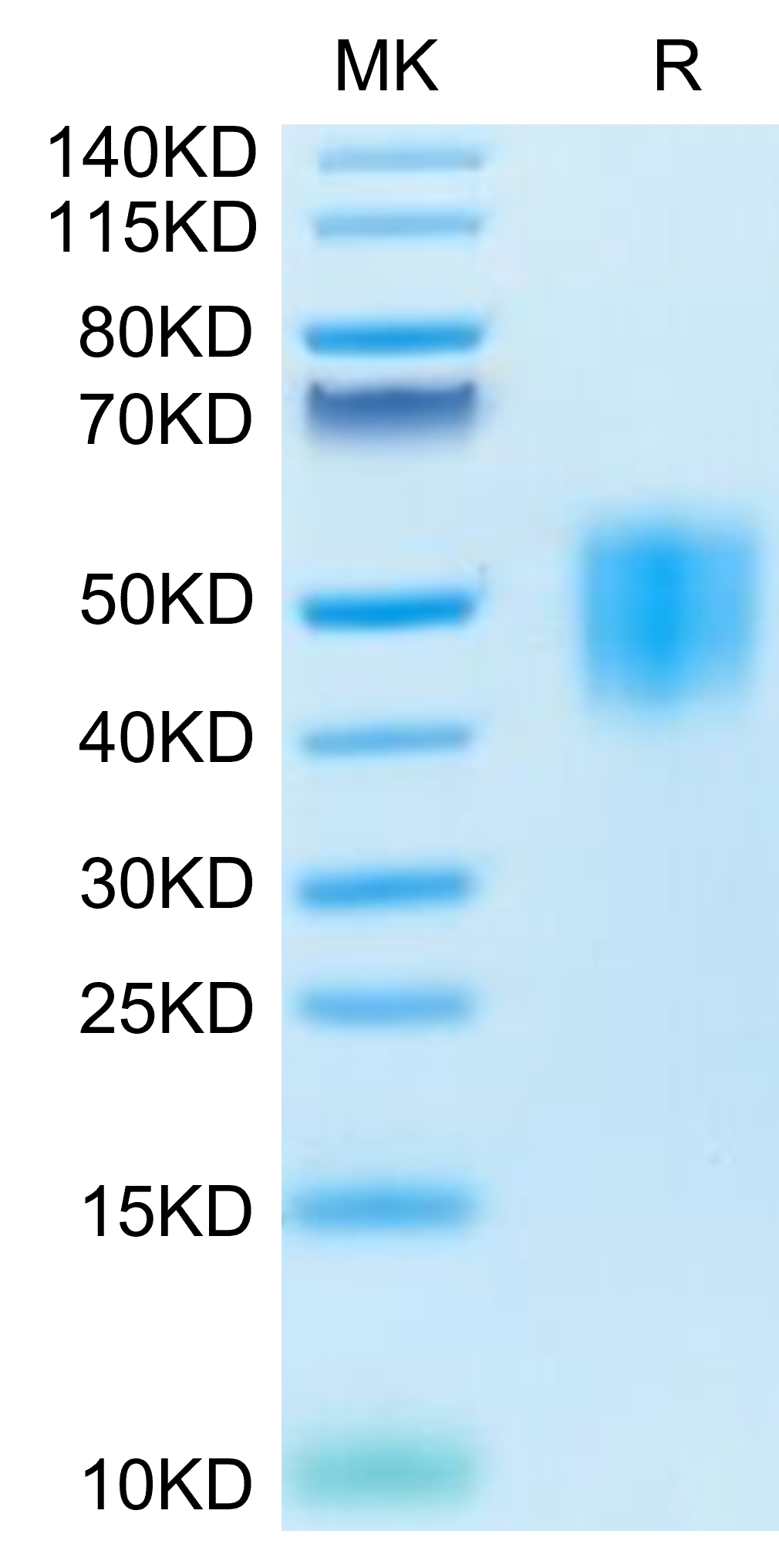 Ghr Two R Human GHR/Growth Hormone R Protein (GHR-HM101) | KACTUS