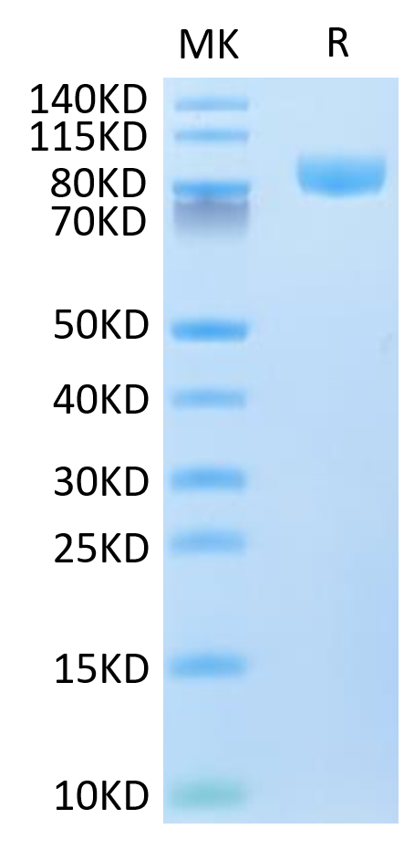 Human VCAM-1/CD106 Protein, Ultra Low Endotoxin (VAM-HM106-UL)