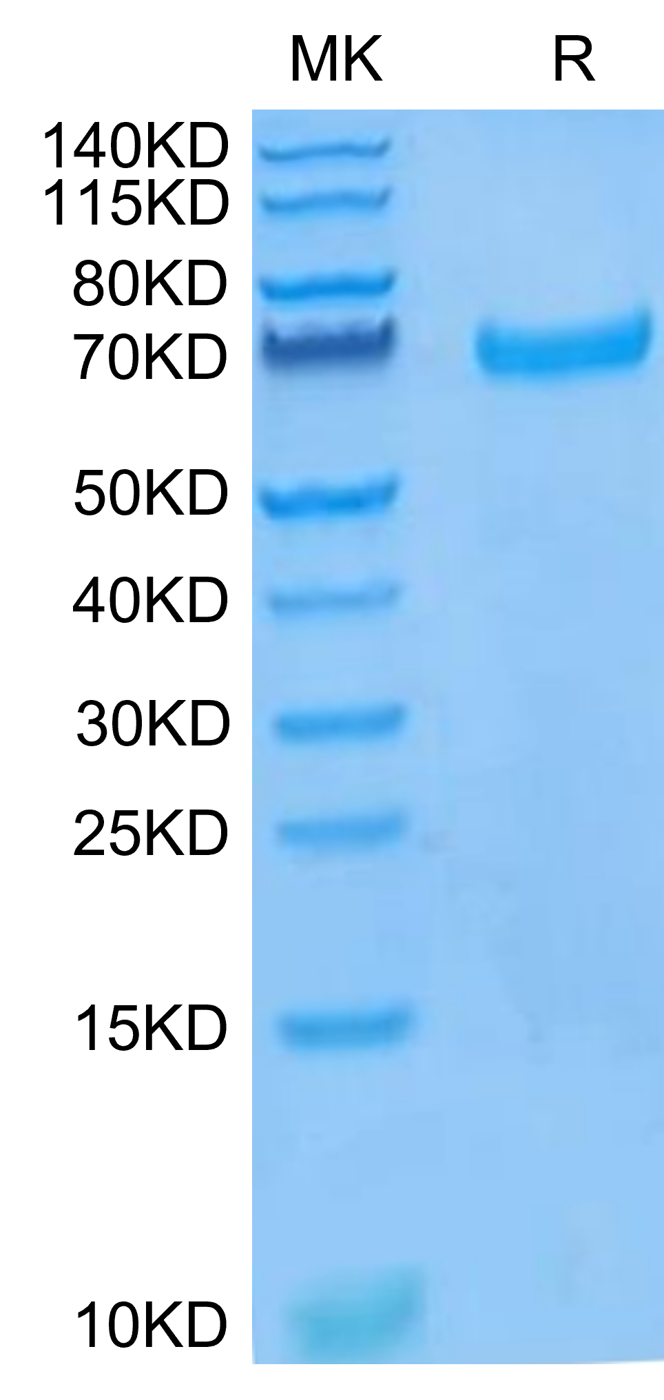 Human EphB4 Protein (EPB-HM104)