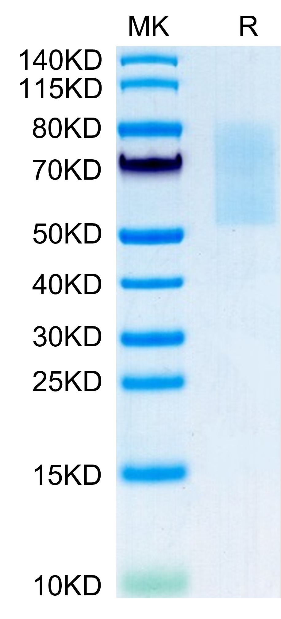 Mouse CX3CL1/Fractalkine Protein, Ultra Low Endotoxin (CX3-MM101-UL)