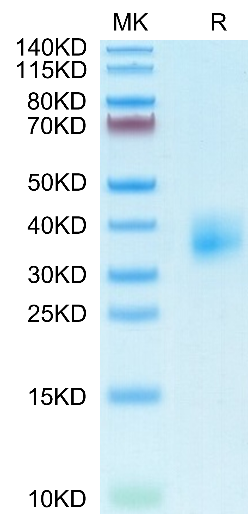 Mouse TSLPR Protein, Ultra Low Endotoxin (TSP-MM10R-UL)