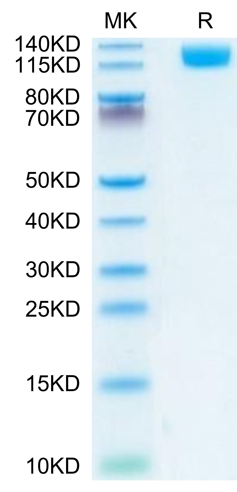 Mouse OSMR beta Protein, Ultra Low Endotoxin (OSM-MM101-UL)