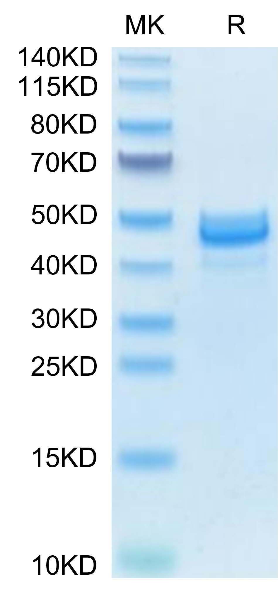 Mouse AREG Protein (AEG-MM201)