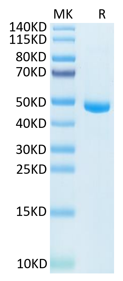 Human IL-20 Protein (IL2-HM120)