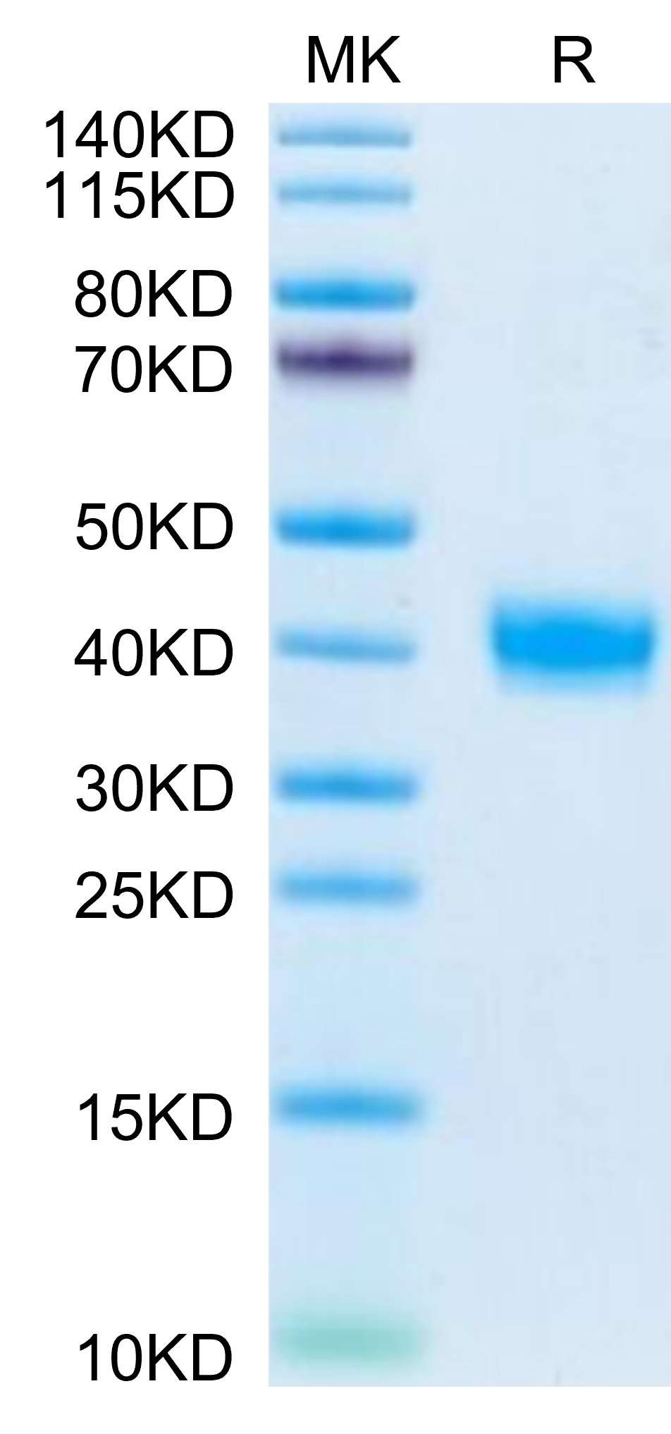 Mouse PRLR Protein (PLR-MM101)