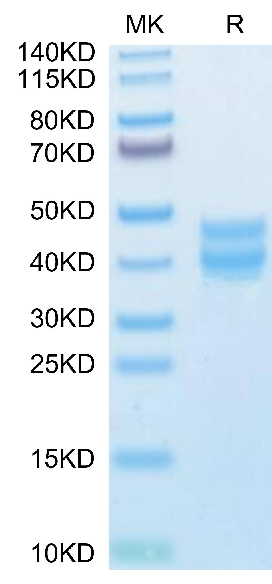 Mouse BST1 Protein (BST-MM101)