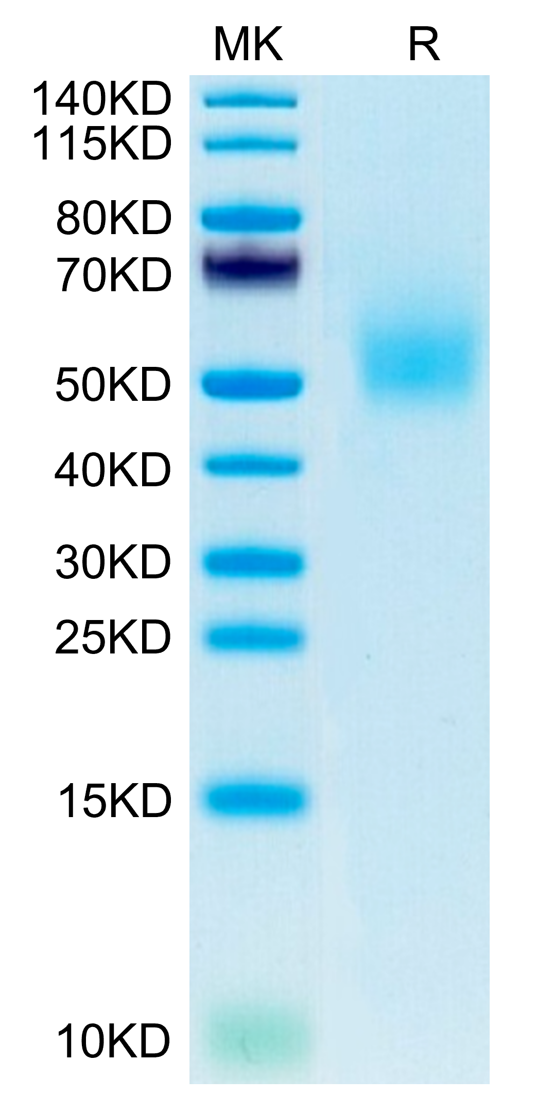 Mouse DLK1 Protein, Ultra Low Endotoxin (DLK-MM101-UL)