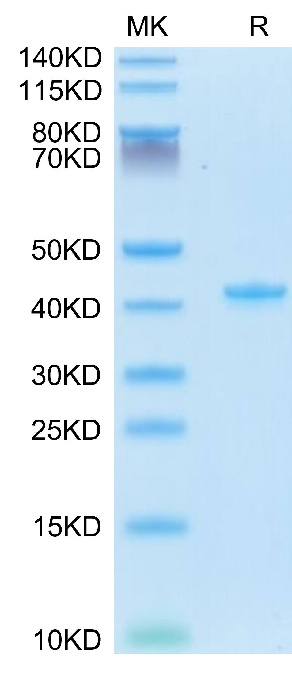 Mouse CCL5 Protein, Ultra Low Endotoxin (CCL-MM205-UL)