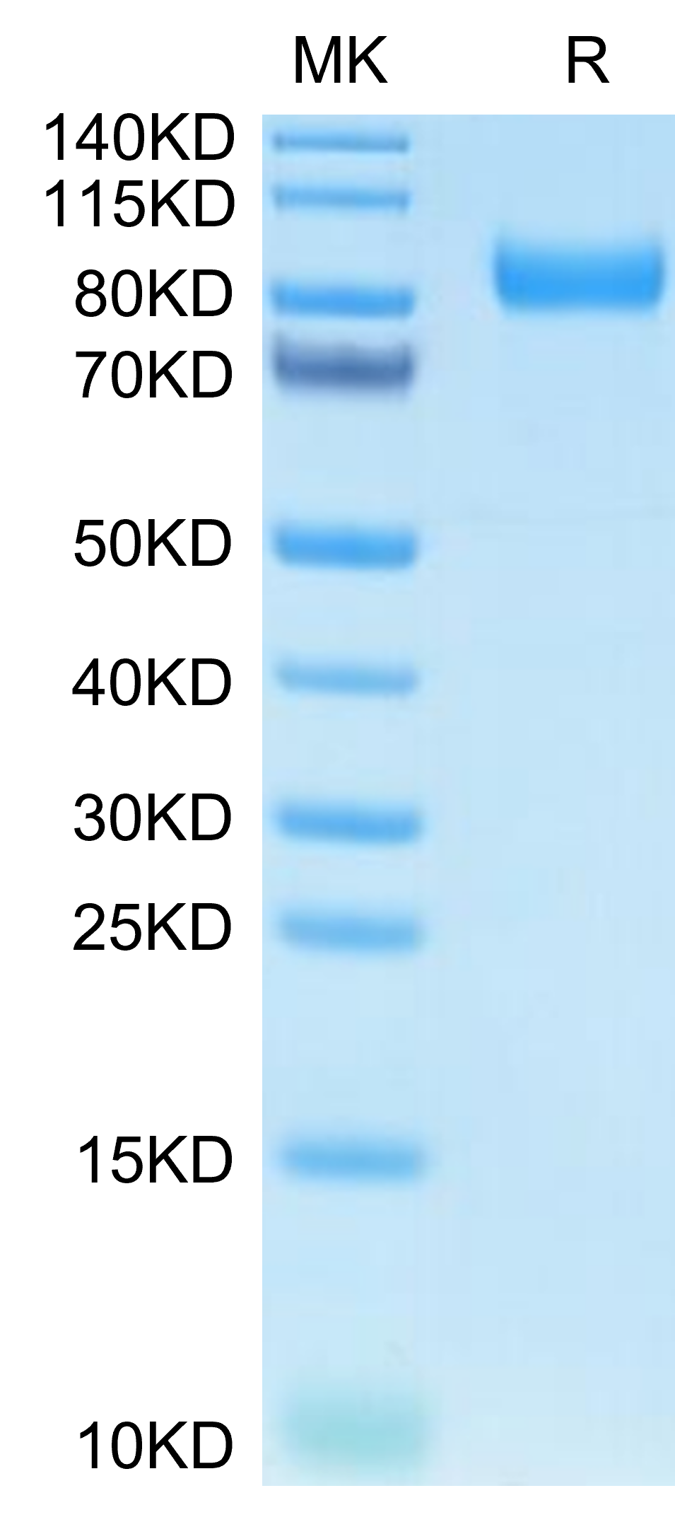 Human Kremen-1 Protein (KRE-HM201)