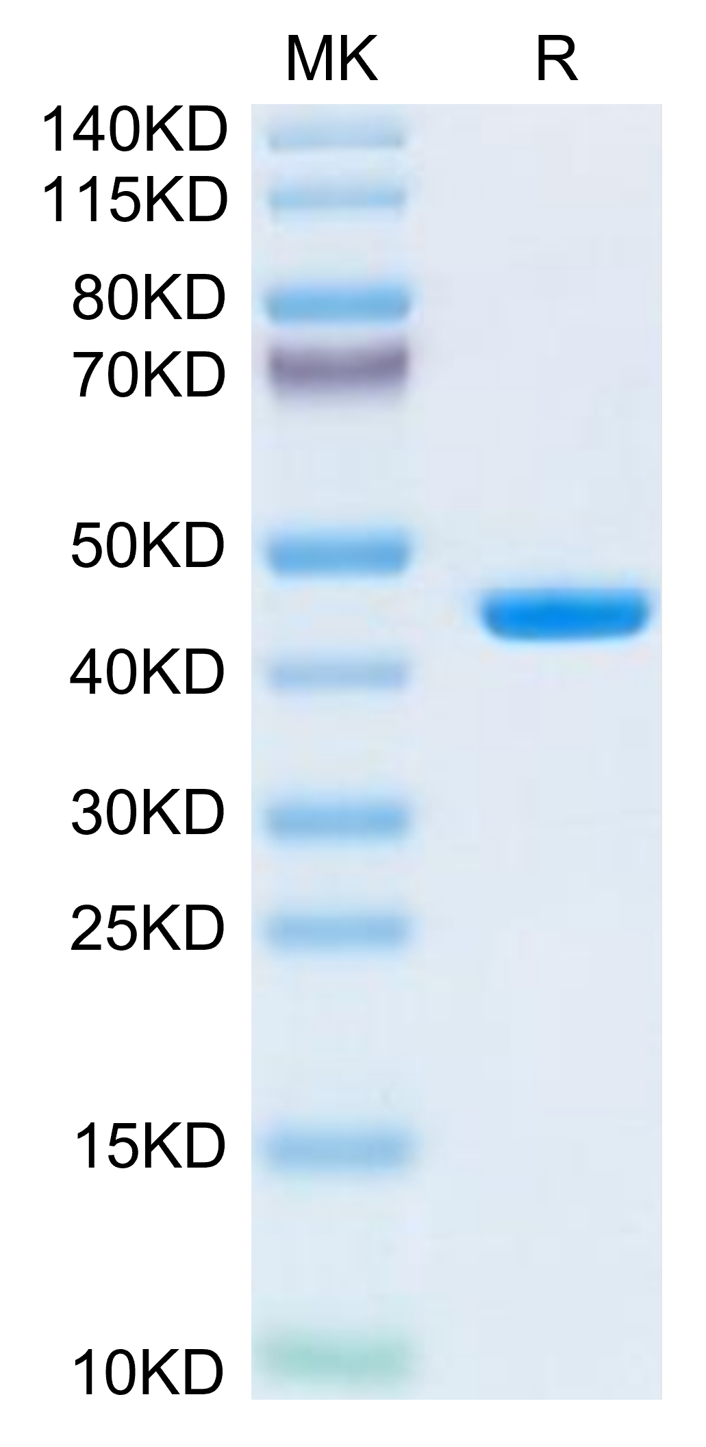 Human B2M/beta 2-Microglobulin Protein, Ultra Low Endotoxin (B2M-HM201-UL)