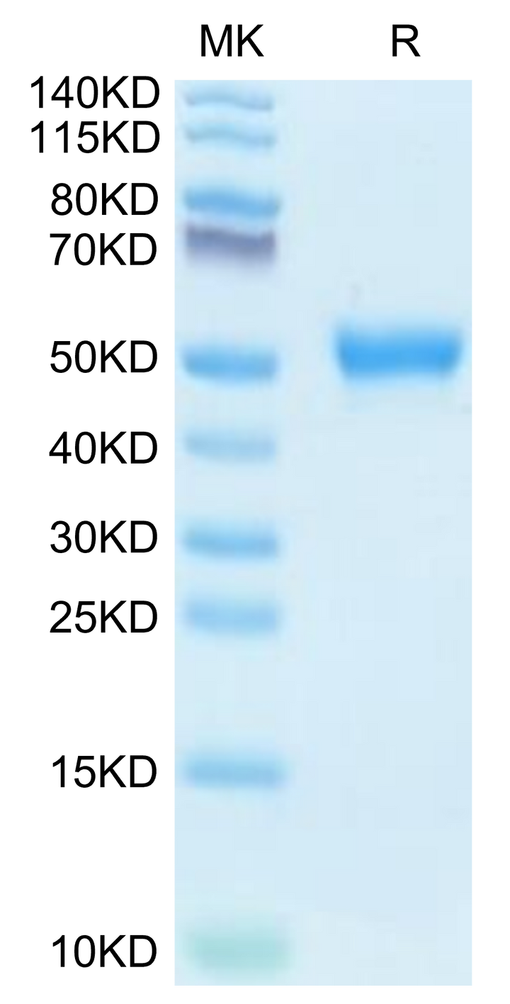 Human AGER Protein (AER-HM101)