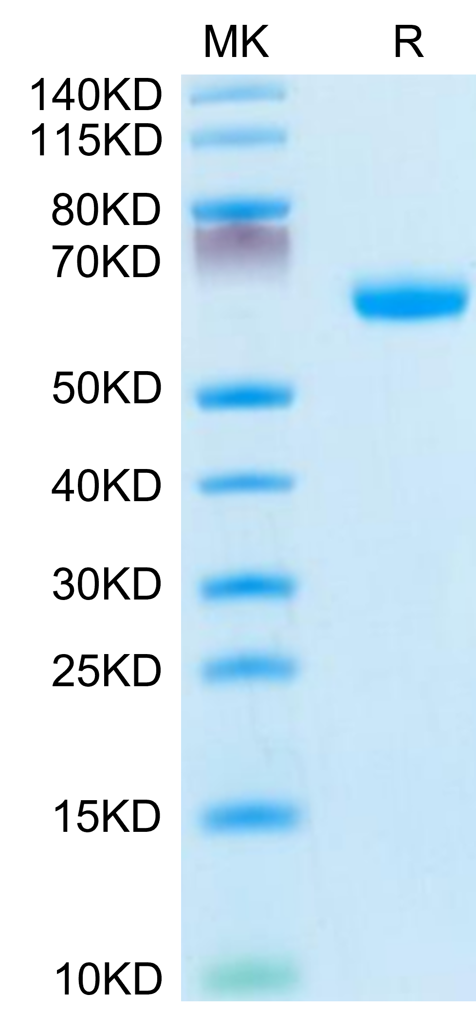 Mouse Ephrin-A3/EFNA3 Protein (EFN-MM2A3)