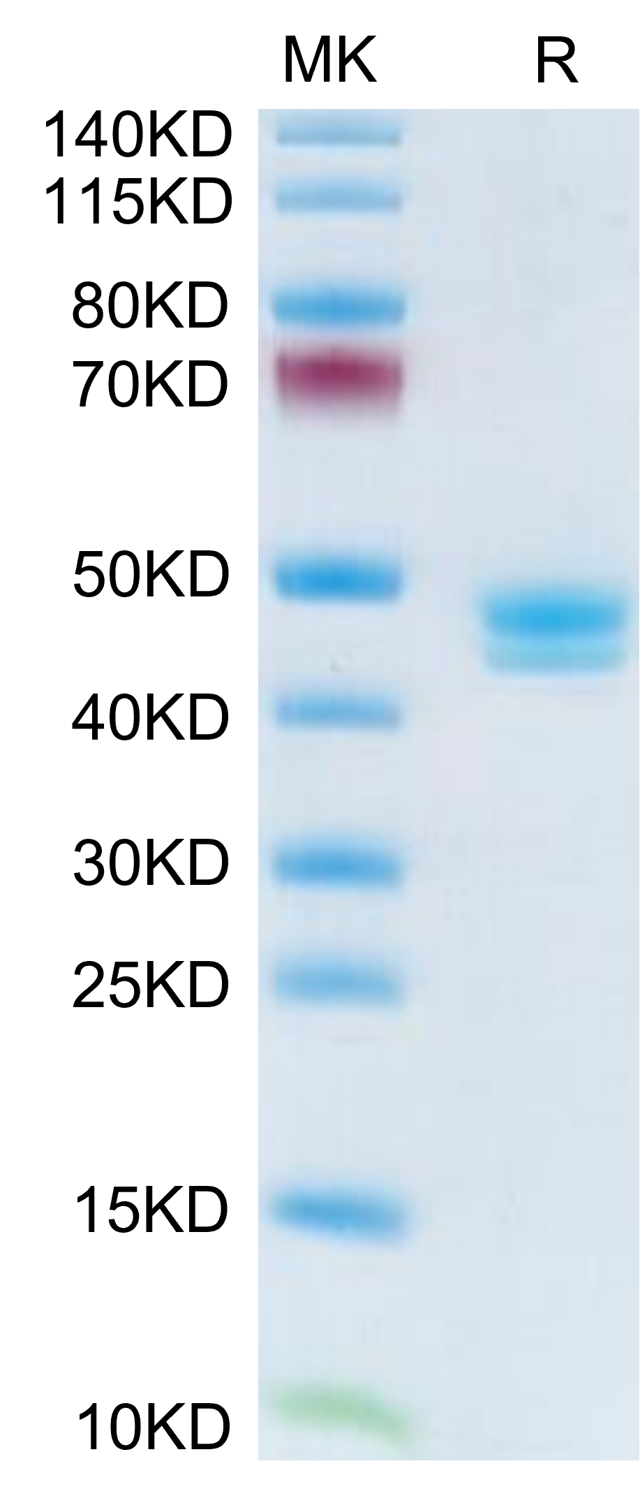 Human MCEMP1 Protein (MCE-HM201)