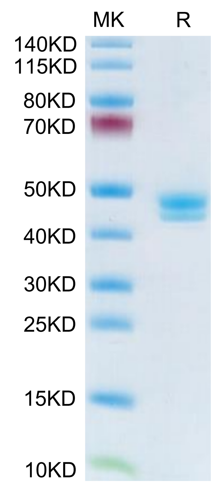 Human MCEMP1 Protein (MCE-HM201)