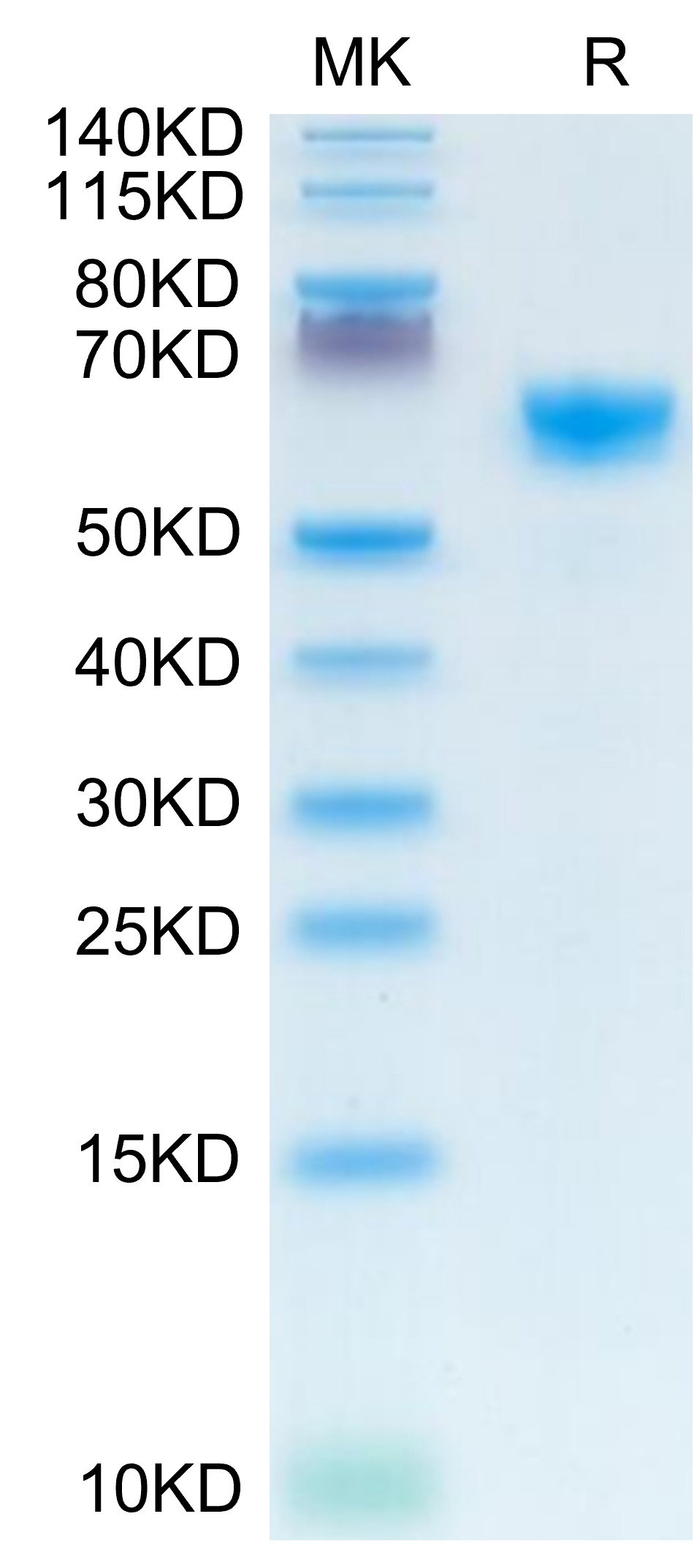 Mouse IGFBP-3R Protein (IGF-MM23R)