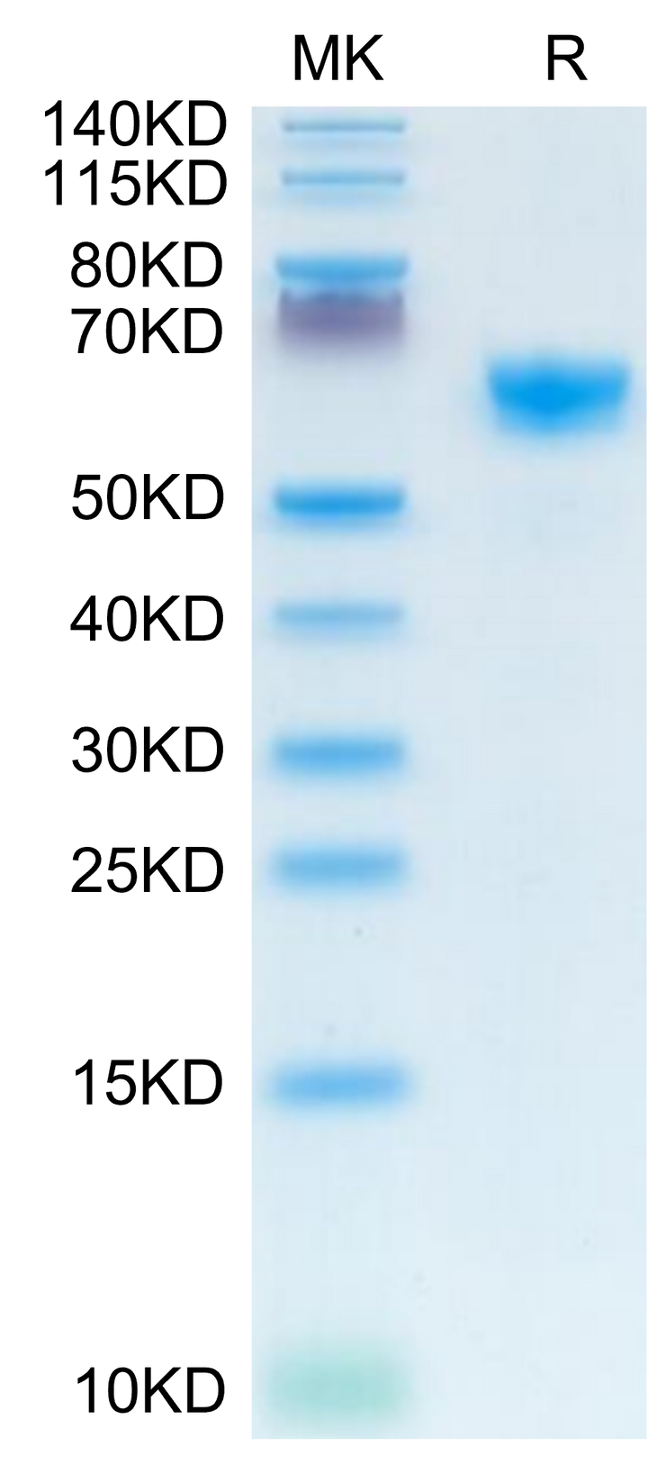 Mouse IGFBP-3R Protein (IGF-MM23R)