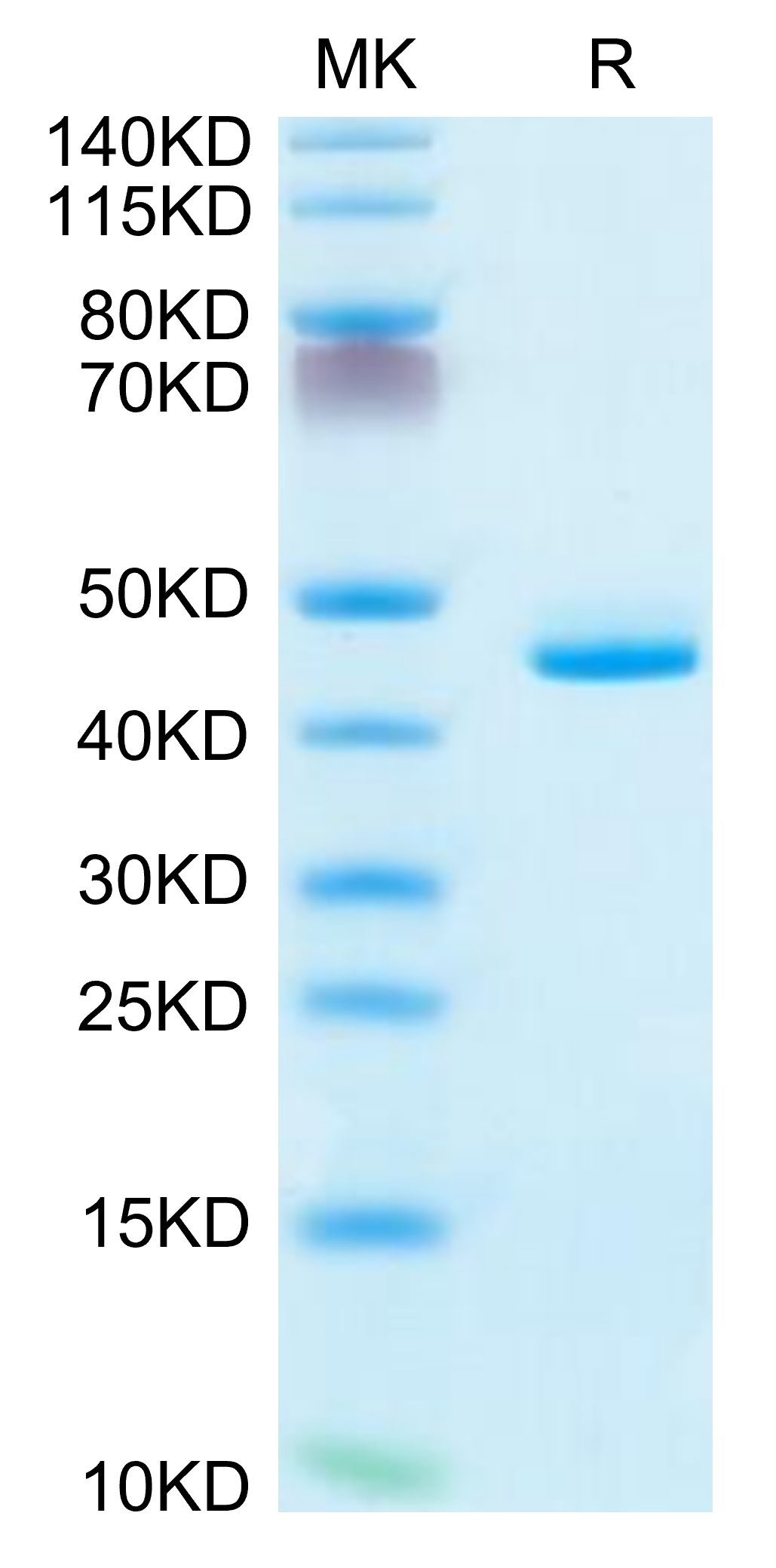 Human CD5L Protein (CD5-HM10L)