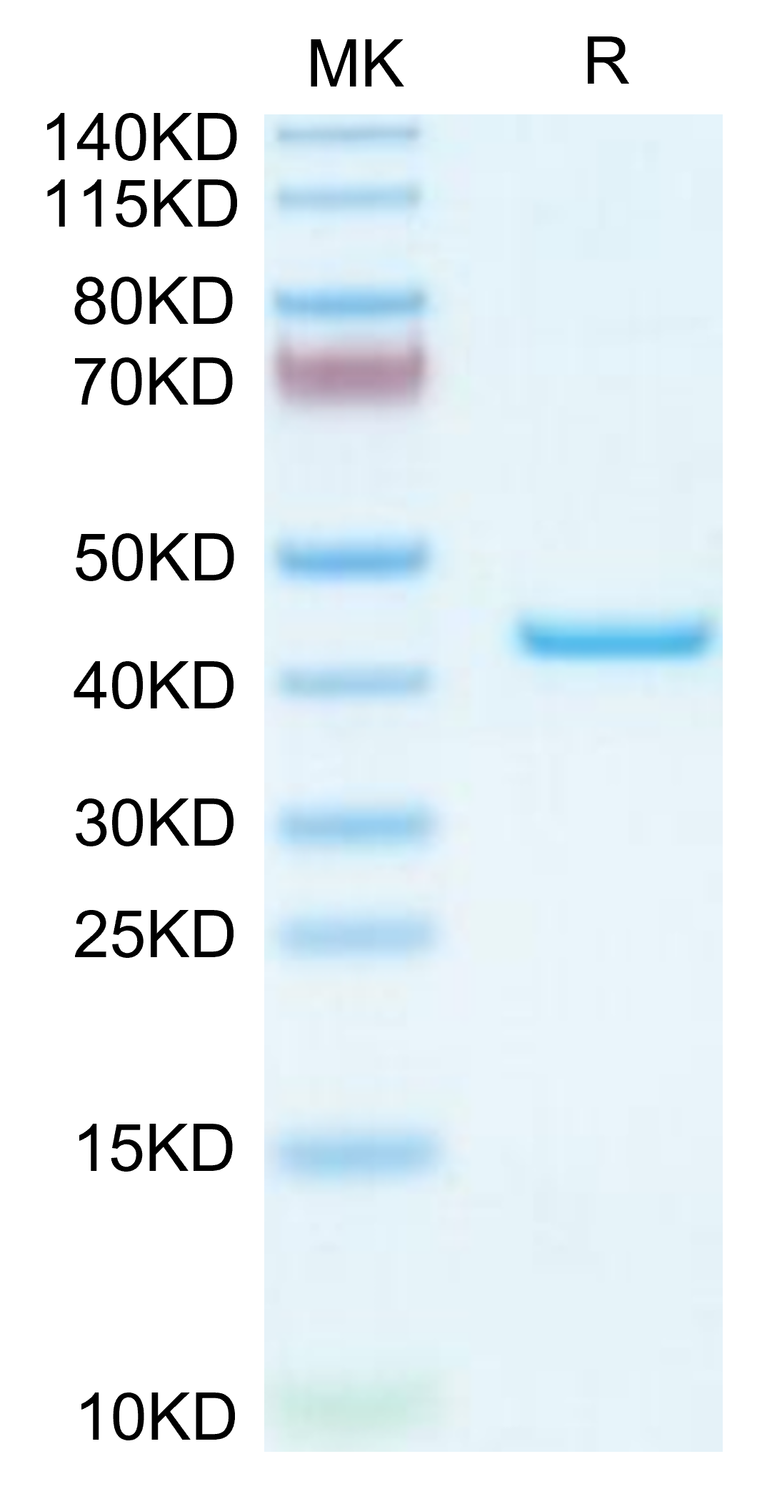 Mouse YKL-40/CHI3L1 Protein, Ultra Low Endotoxin (YKL-MM140-UL)