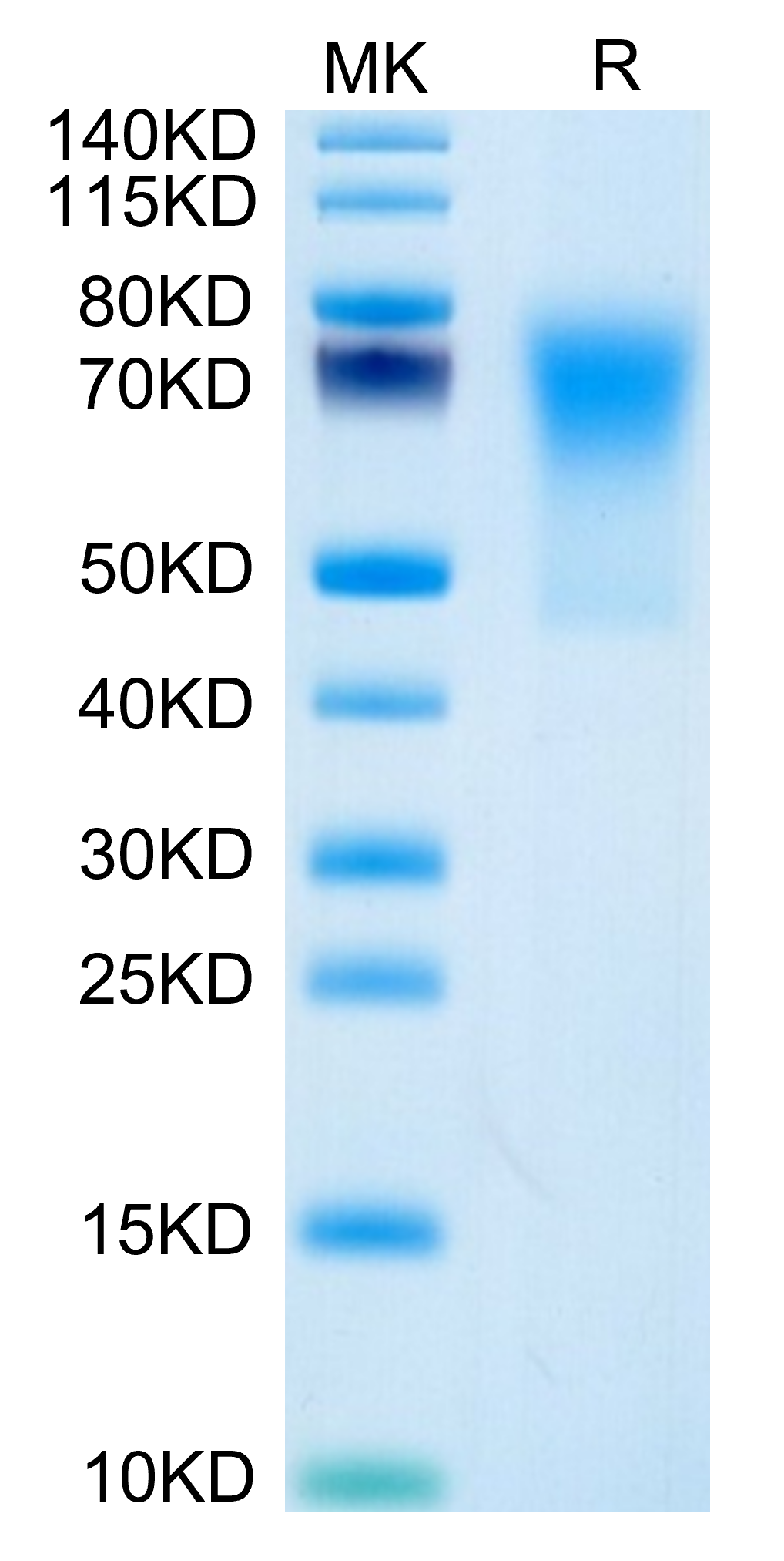 Human TRAIL R3/DcR1 Protein (TRA-HM103)