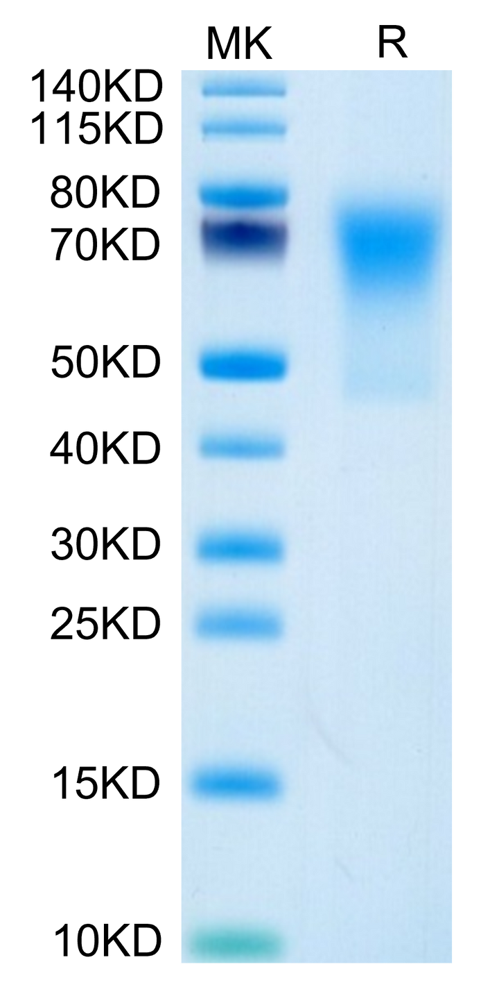 Human TRAIL R3/DcR1 Protein (TRA-HM103)