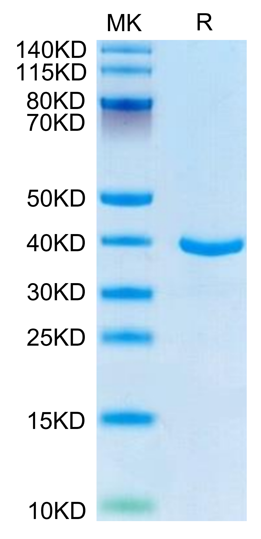 Human ANXA1 Protein, Ultra Low Endotoxin (ANX-HE1A1-UL)
