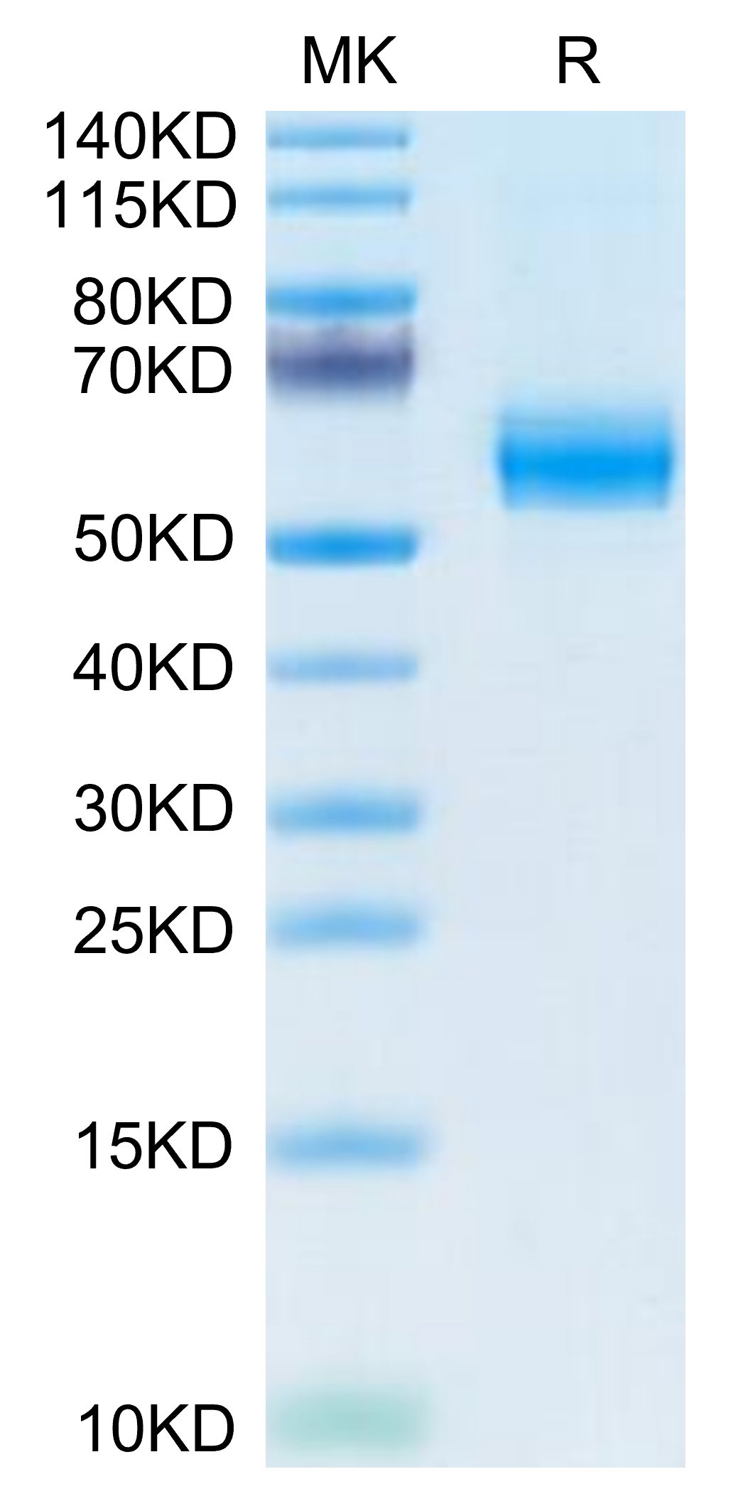 Mouse PLA2G7 Protein, Ultra Low Endotoxin (PLA-MM107-UL)