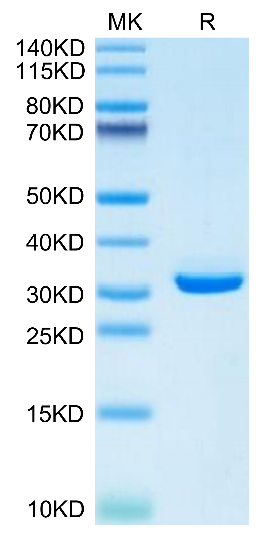 Mouse APOE/Apolipoprotein E Protein (APO-MM102)