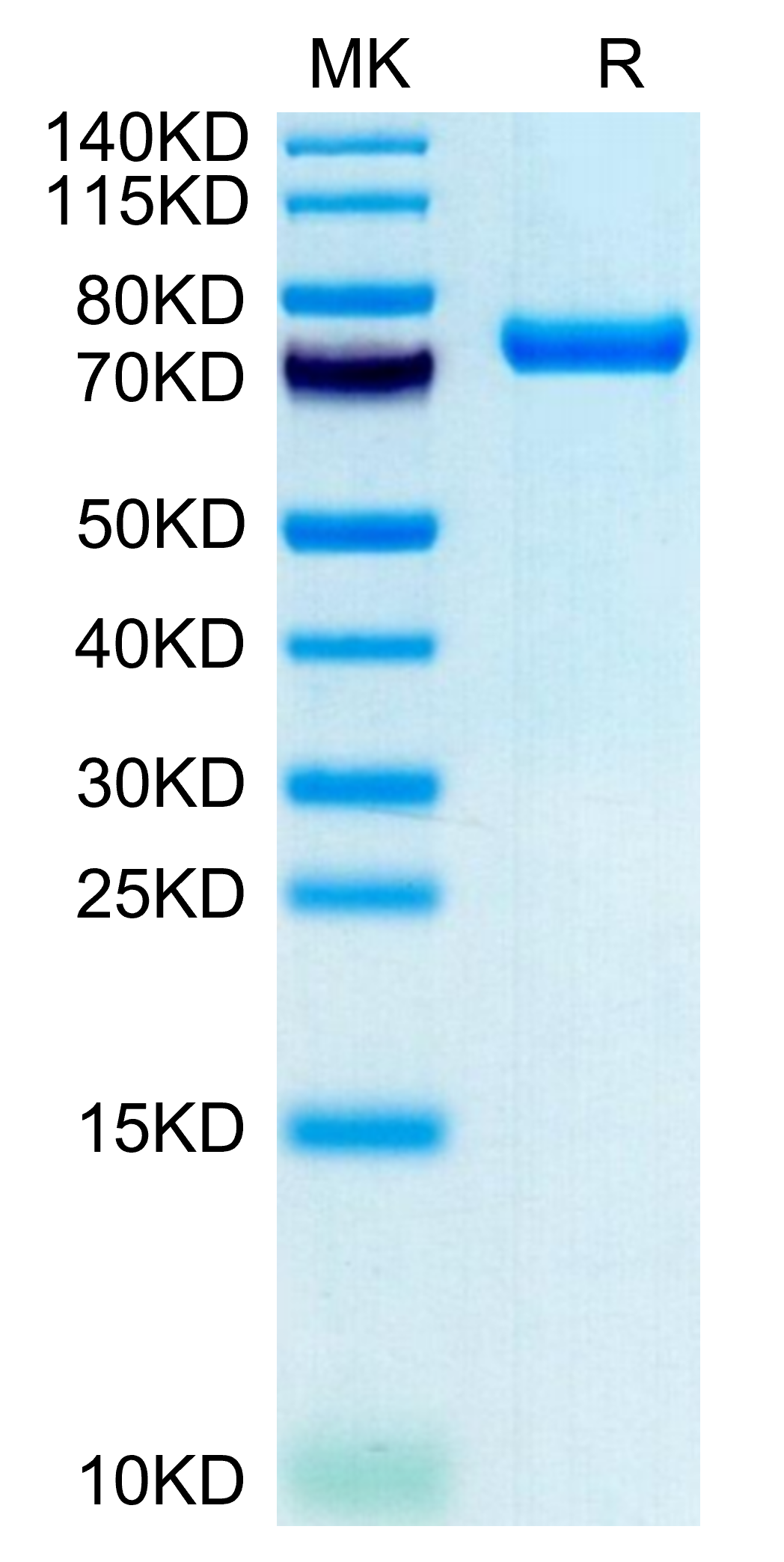 Non-biotinylated Human CLEC2D Protein, Ultra Low Endotoxin (CLD-HM52D-UL)