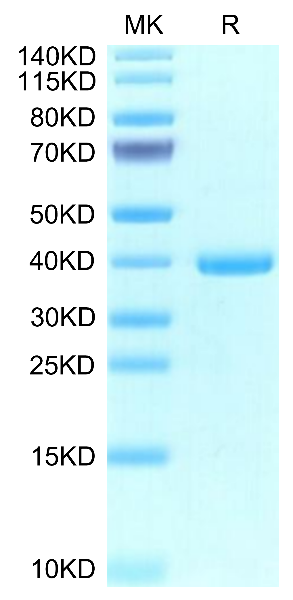 Human EREG Protein, Ultra Low Endotoxin (ERE-HM201-UL)