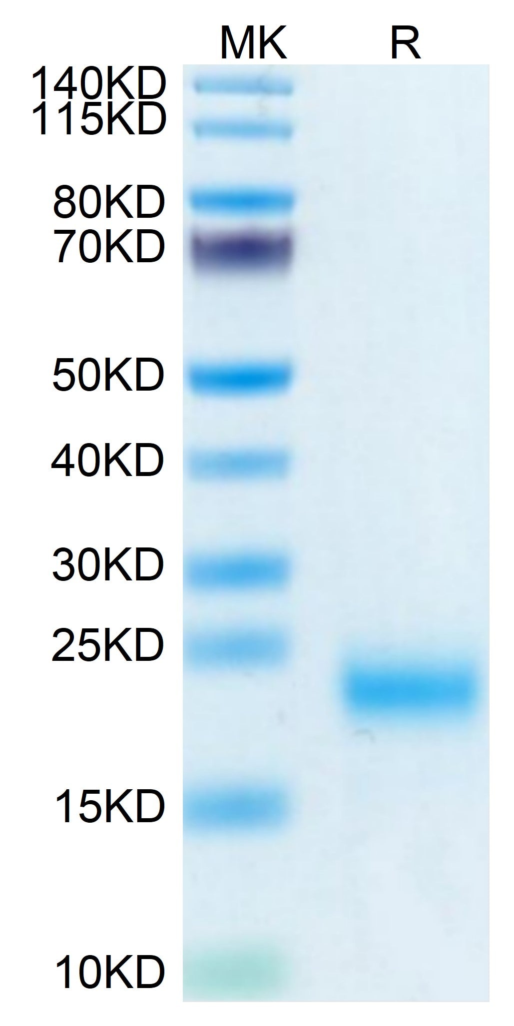 Human/Cynomolgus/Rhesus macaque ROR1 (165-305, Frizzled Domain) Protein (ROR-HM10F)