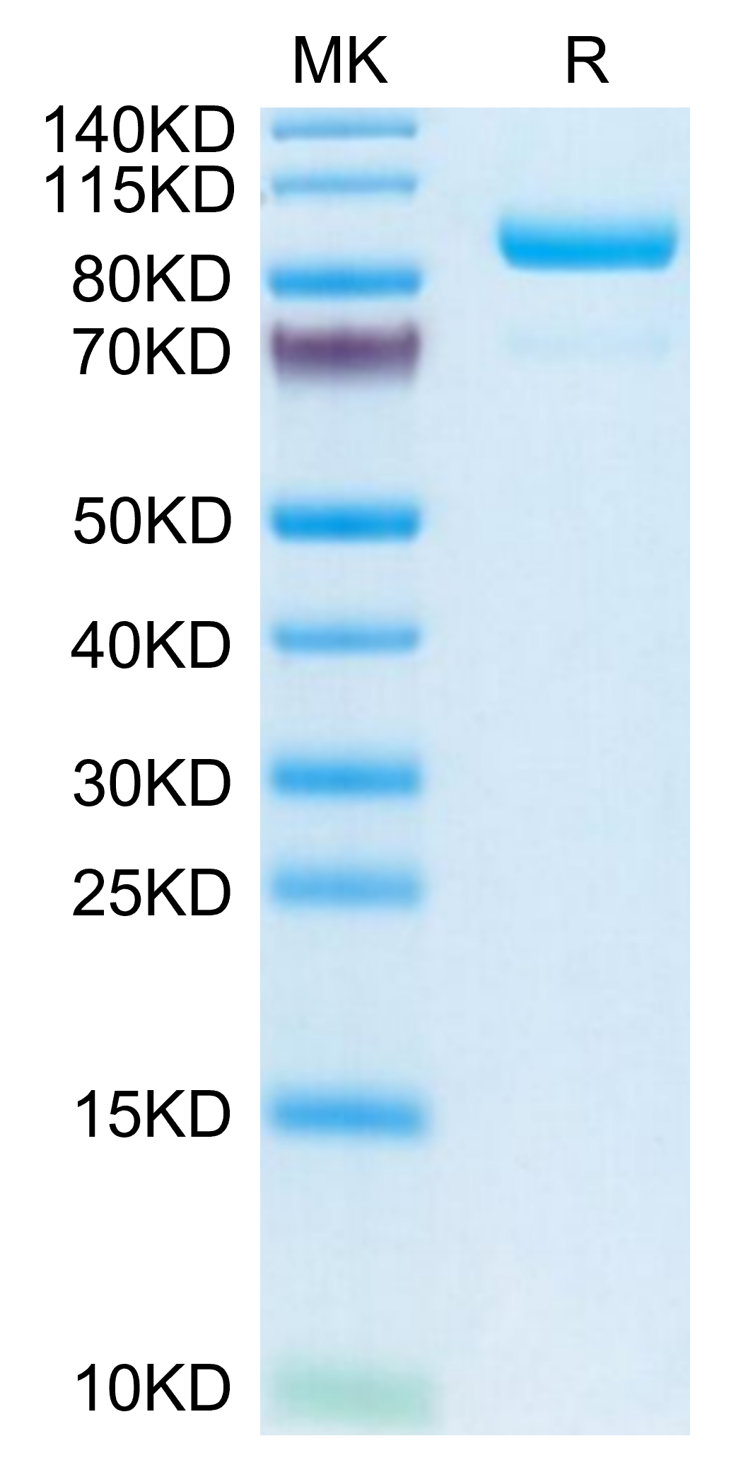 Human Complement Component C2 Protein (CC2-HM101)