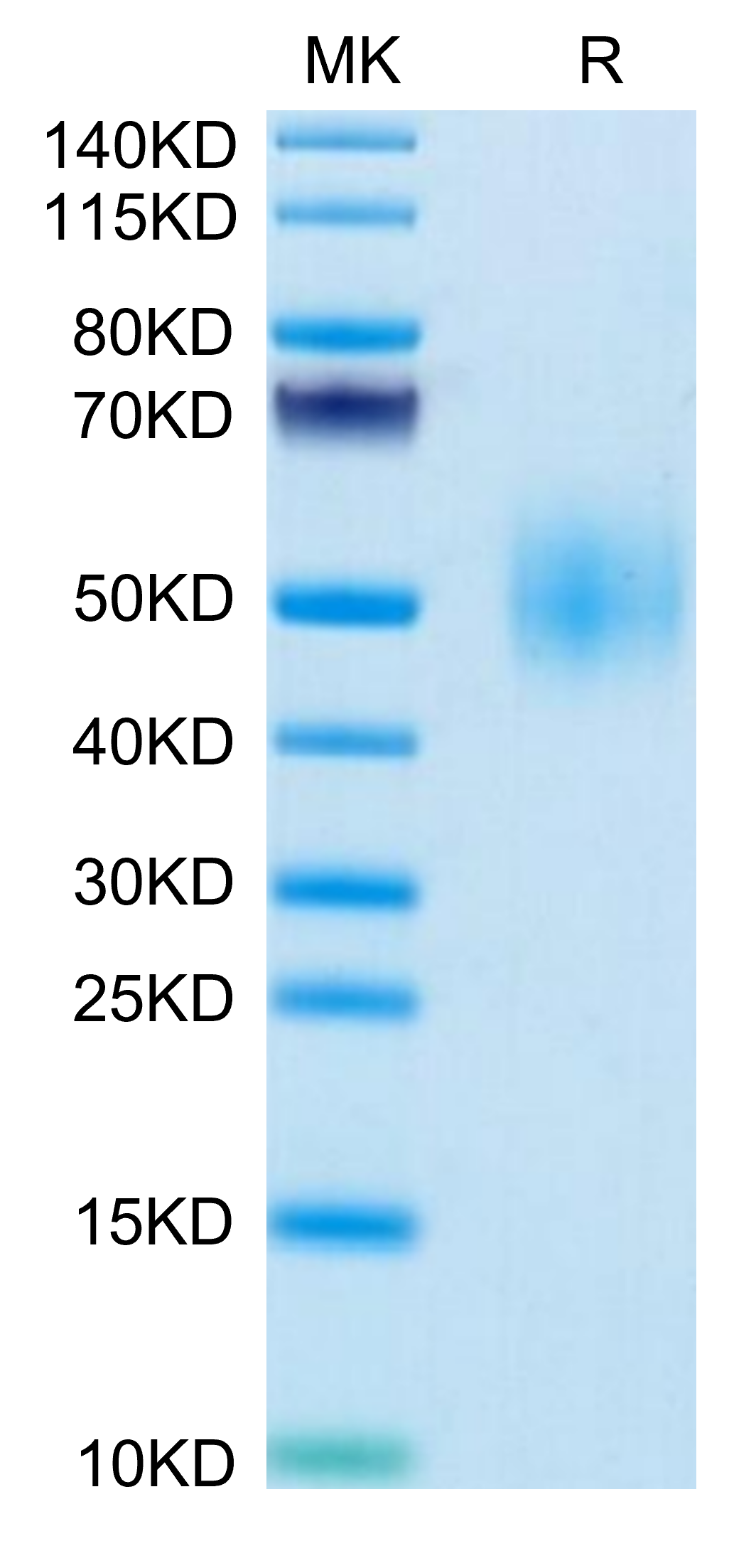 Mouse SLAMF1/SLAM/CD150 Protein, Ultra Low Endotoxin (SLA-MM1MF-UL)