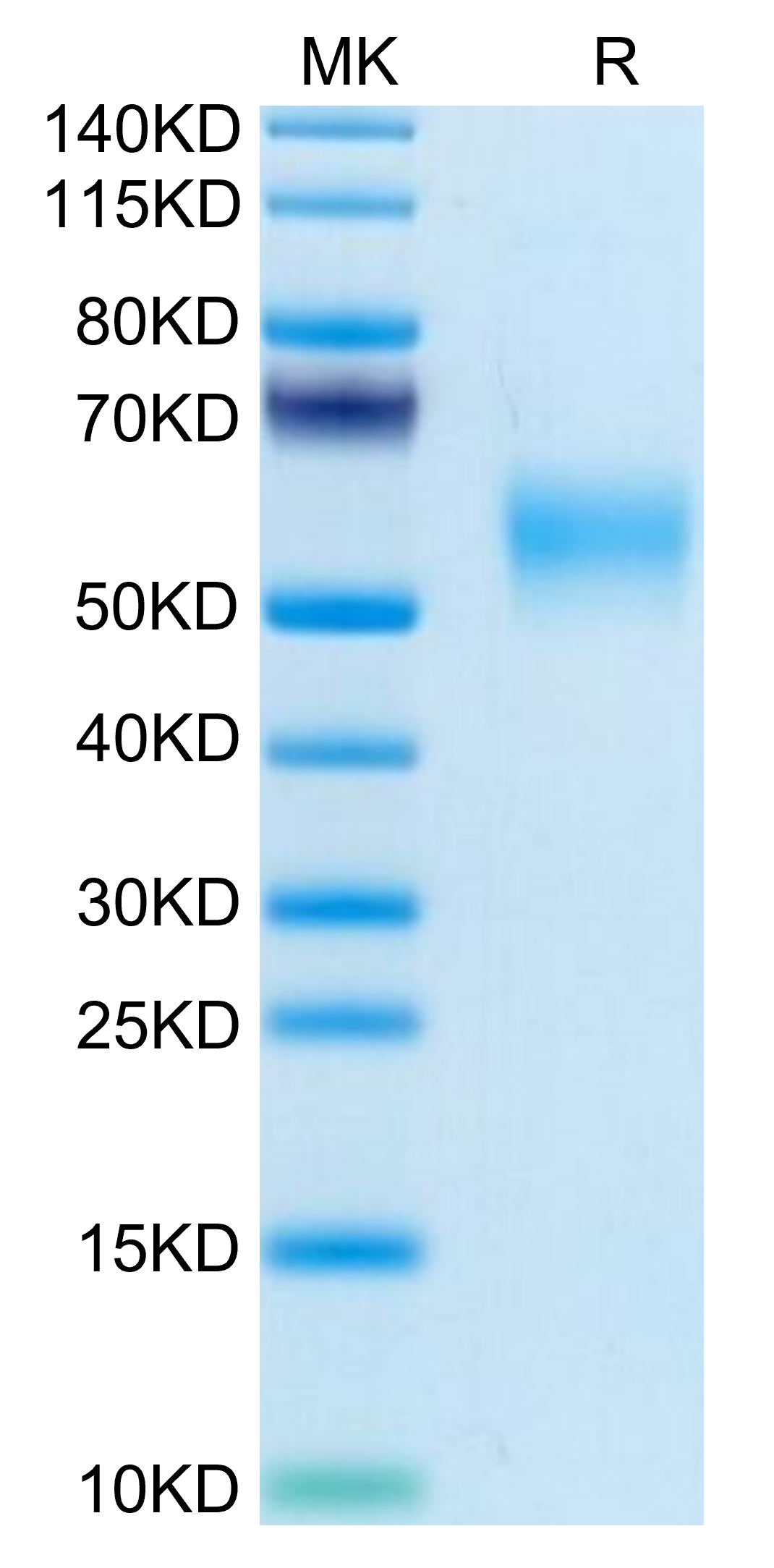 Mouse LOX1 Protein, Ultra Low Endotoxin (LOX-MM101-UL)