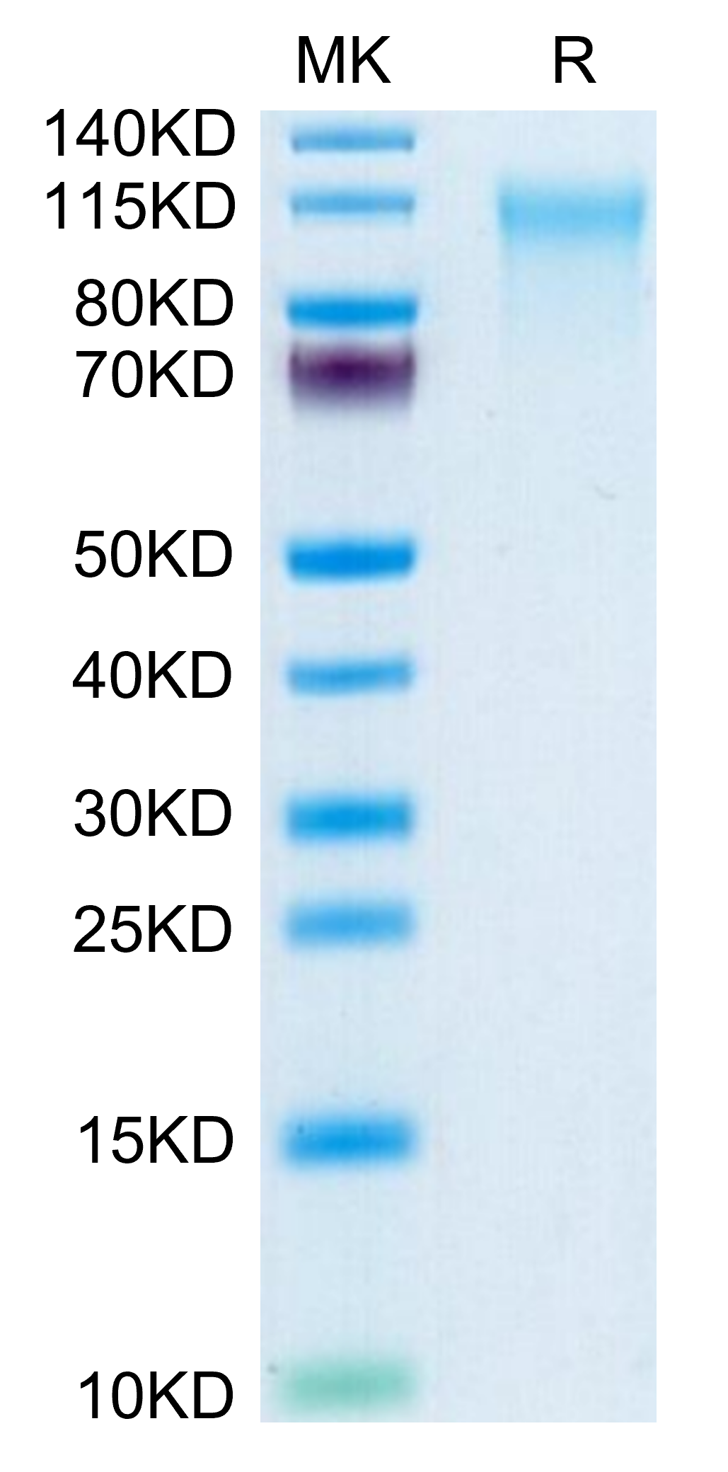 Human CD164 Protein, Ultra Low Endotoxin (CD6-HM204-UL)