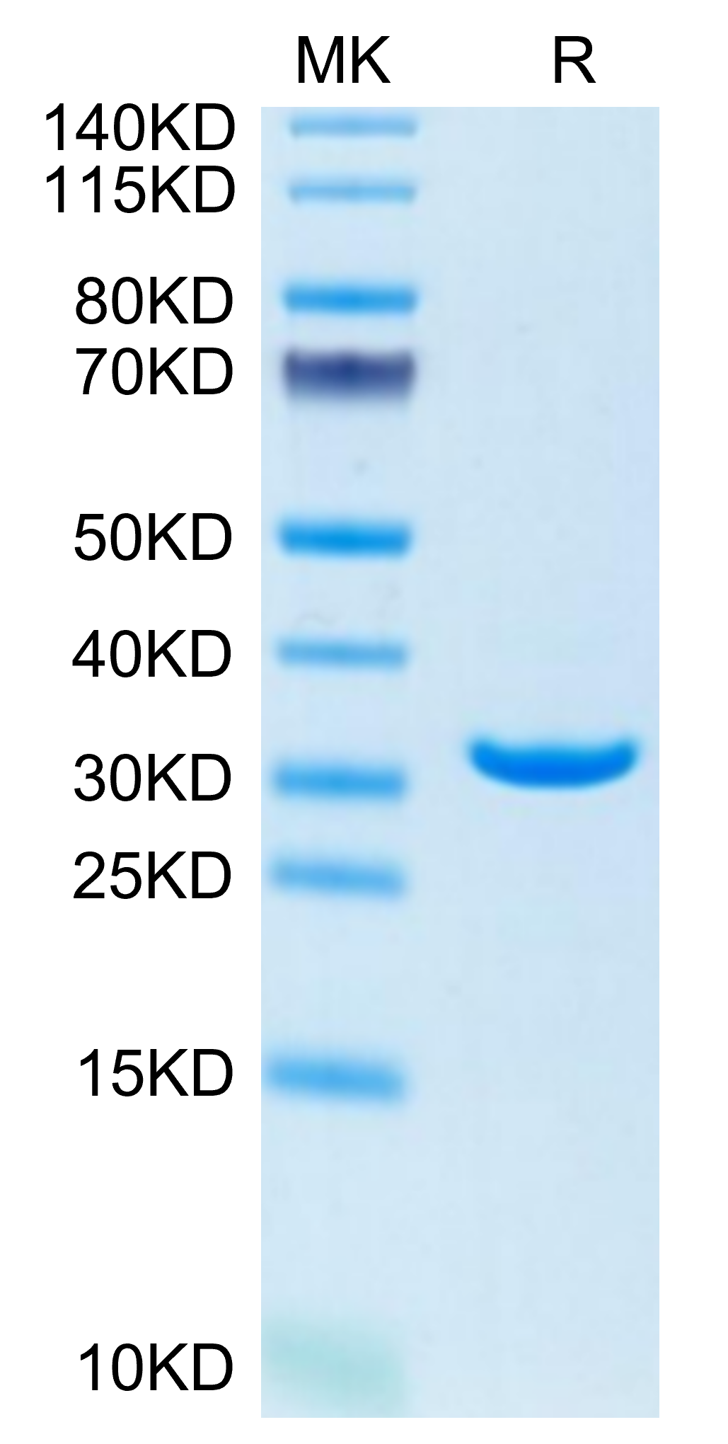 Human Annexin V/ANXA5 Protein (AN5-HE005)