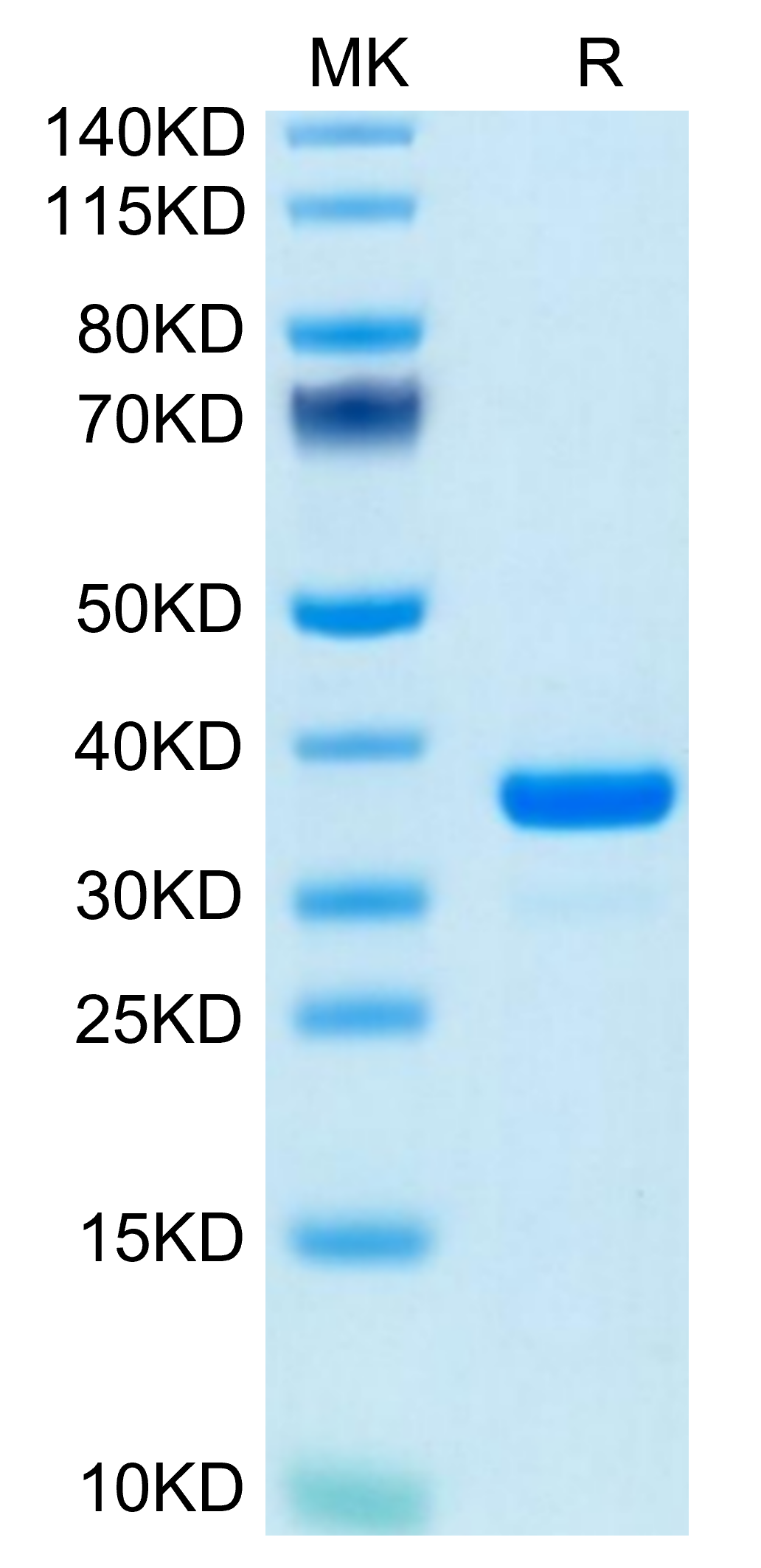 Mouse IGFBP-7 Protein, Ultra Low Endotoxin (IGF-MM1BP-UL)