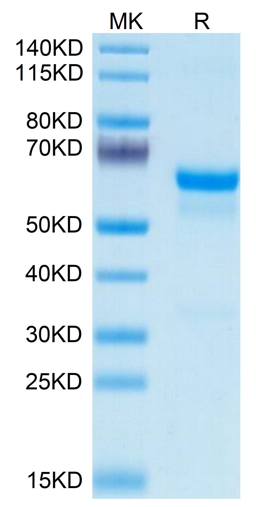 Mouse PRNP Protein, Ultra Low Endotoxin (PRP-MM201-UL)