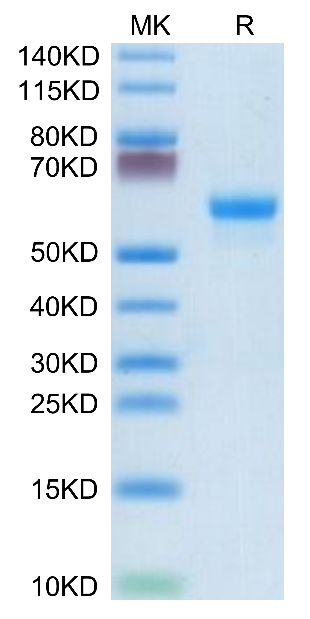 Mouse CLEC4A/DCIR Protein, Ultra Low Endotoxin (CLE-MM24A-UL)