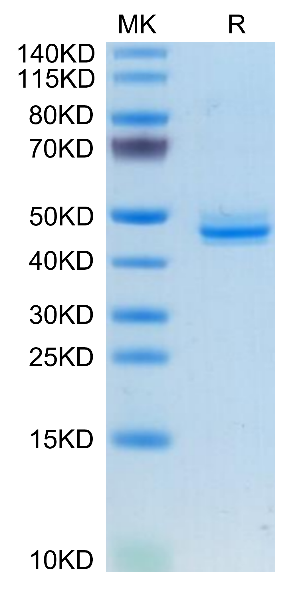 Human CALCA/CGRP Protein, Ultra Low Endotoxin (CAL-HM201-UL)