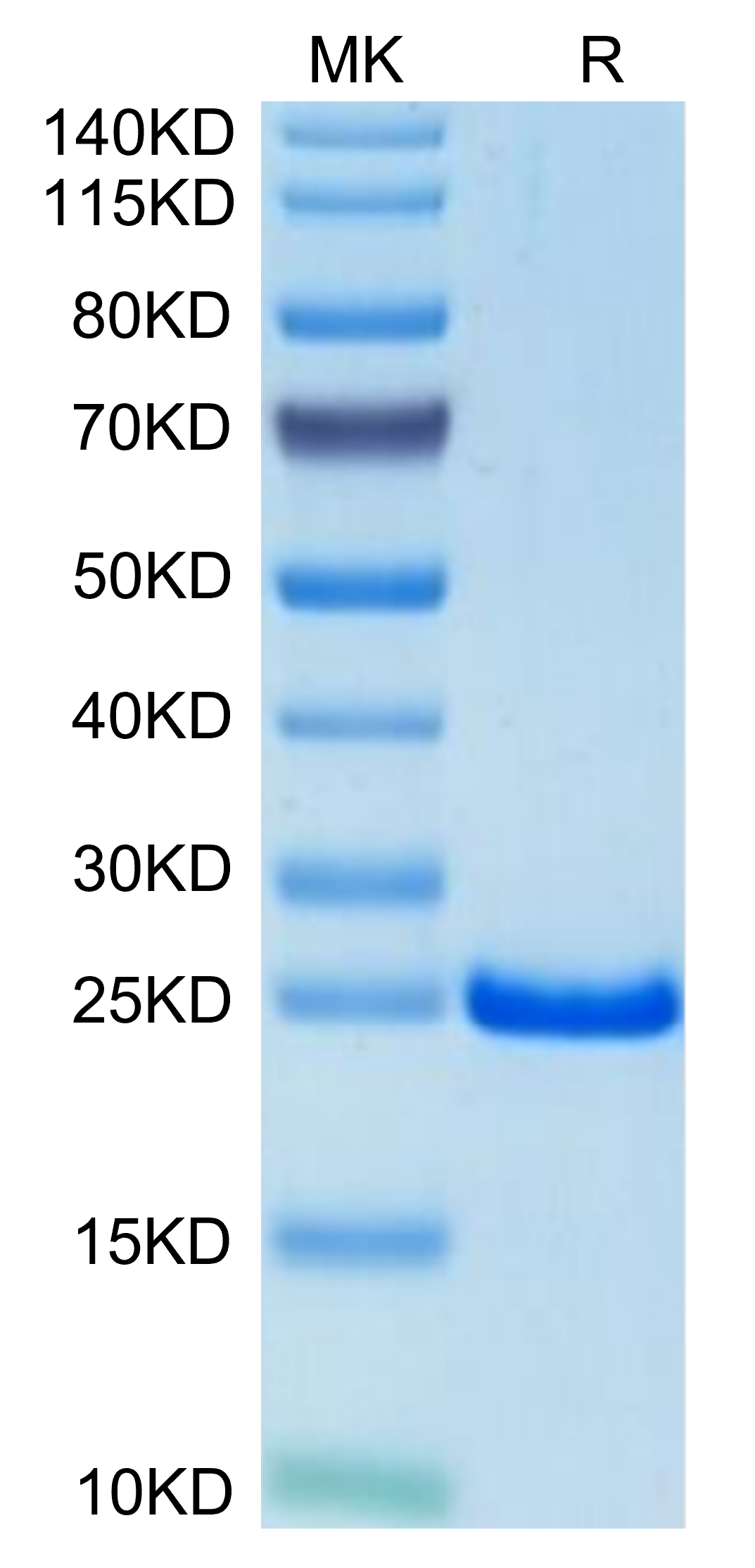 Mouse TIMP-2 Protein, Ultra Low Endotoxin (TIM-MM1P2-UL)
