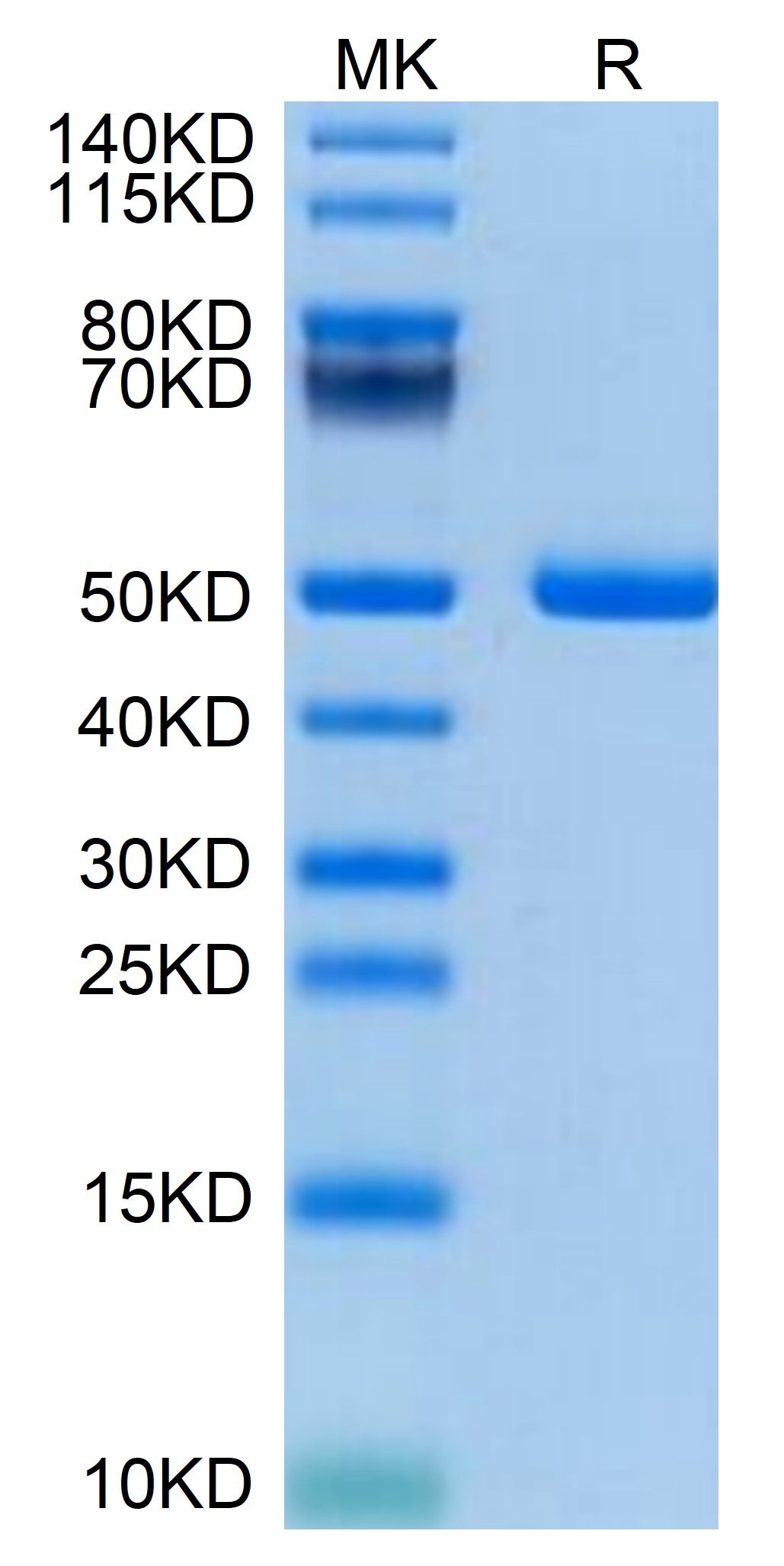 Mouse PSMP Protein (PSM-MM201)