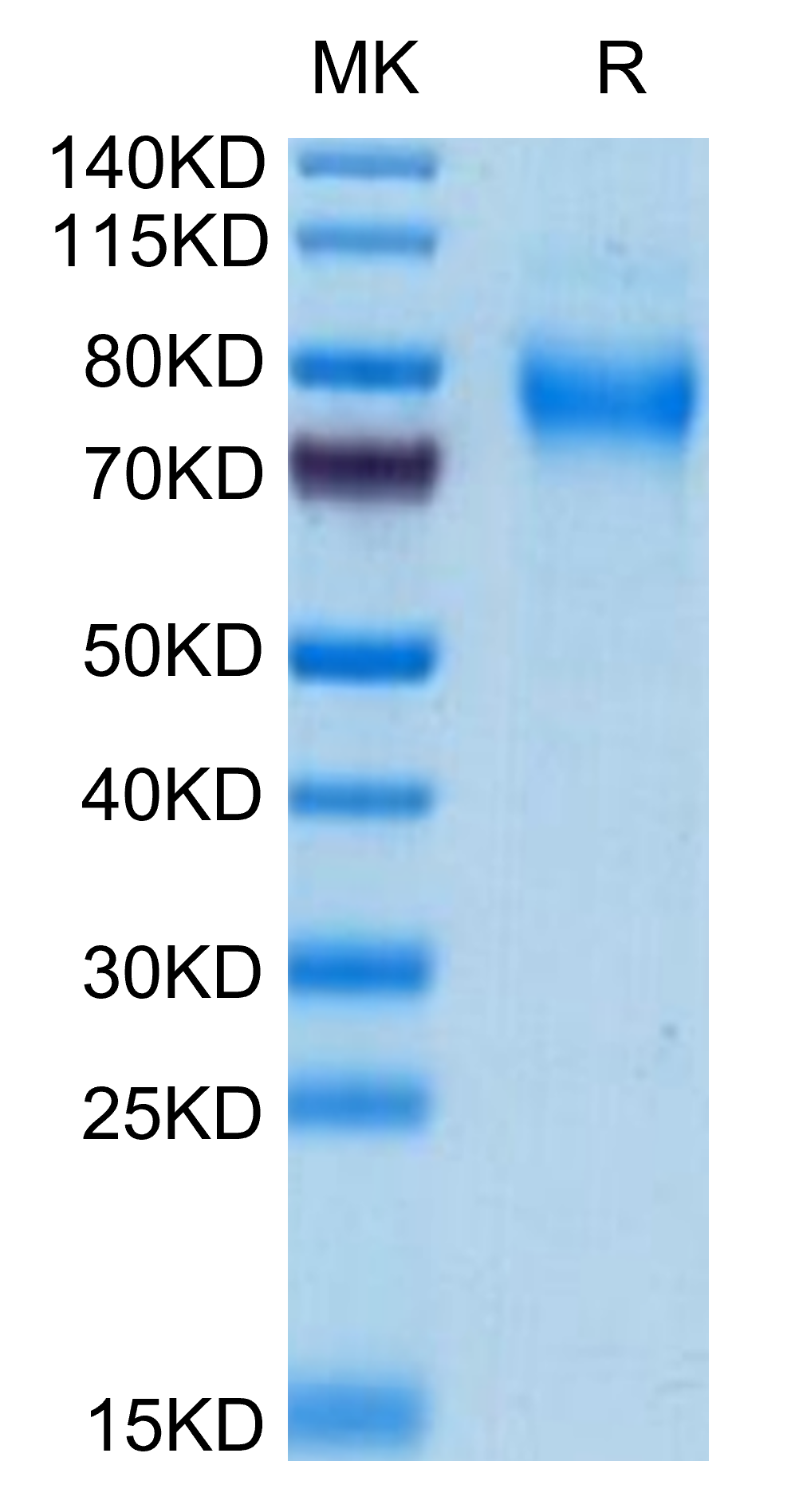 Mouse TREML2/TLT-2 Protein (TLT-MM102)