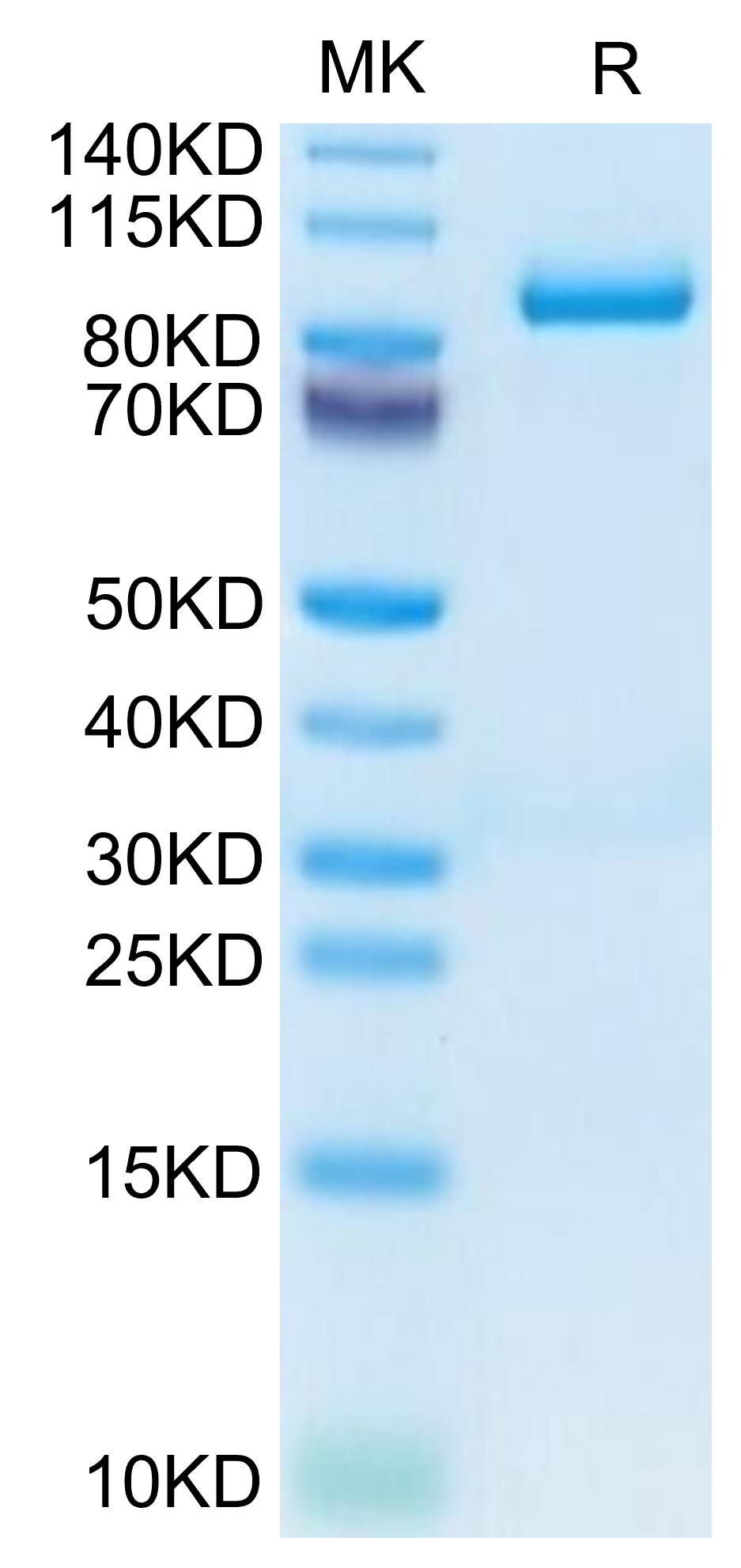 Mouse Periostin/OSF-2 Protein (OSF-MM102)