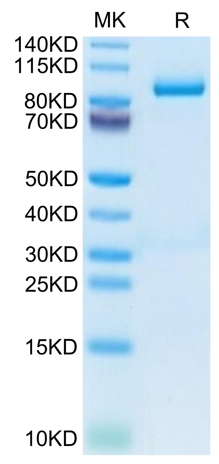 Mouse Periostin/OSF-2 Protein (OSF-MM102)