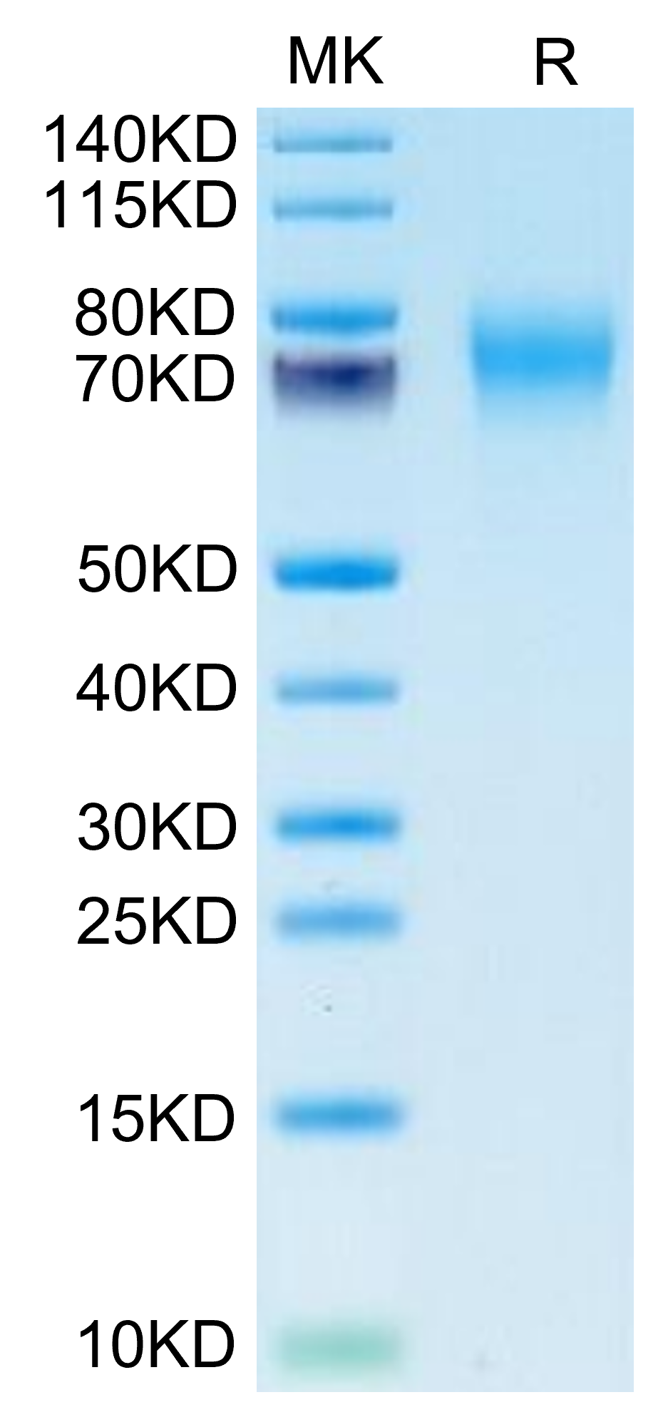 Biotinylated Human FGFR2 alpha (IIIc) Protein, Ultra Low Endotoxin (FGR-HM4CDB-UL)