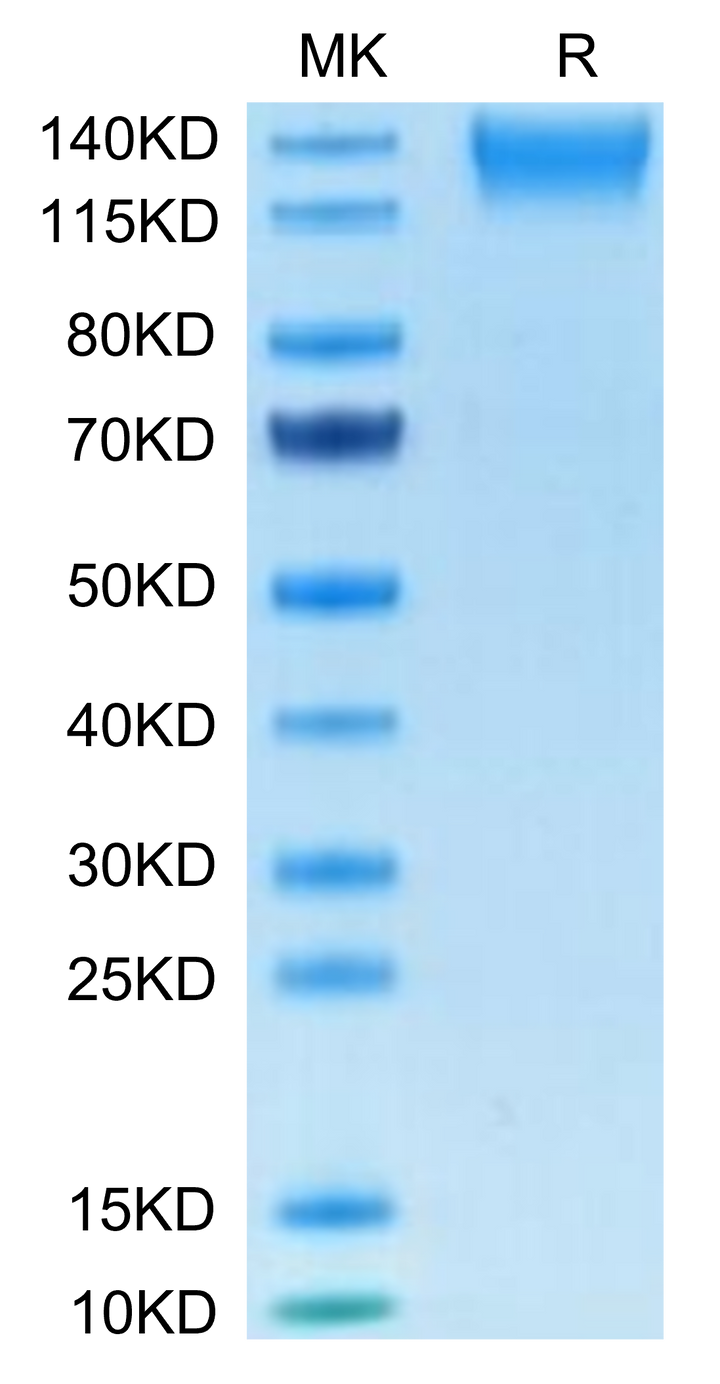 Human SEZ6L2 Protein (SEZ-HM1L2)