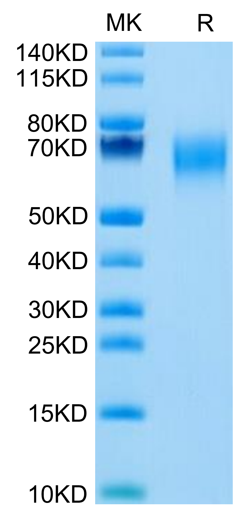 Cynomolgus IL-1 Rrp2/IL-1 R6 Protein, Ultra Low Endotoxin (IL1-CM1L2-UL)