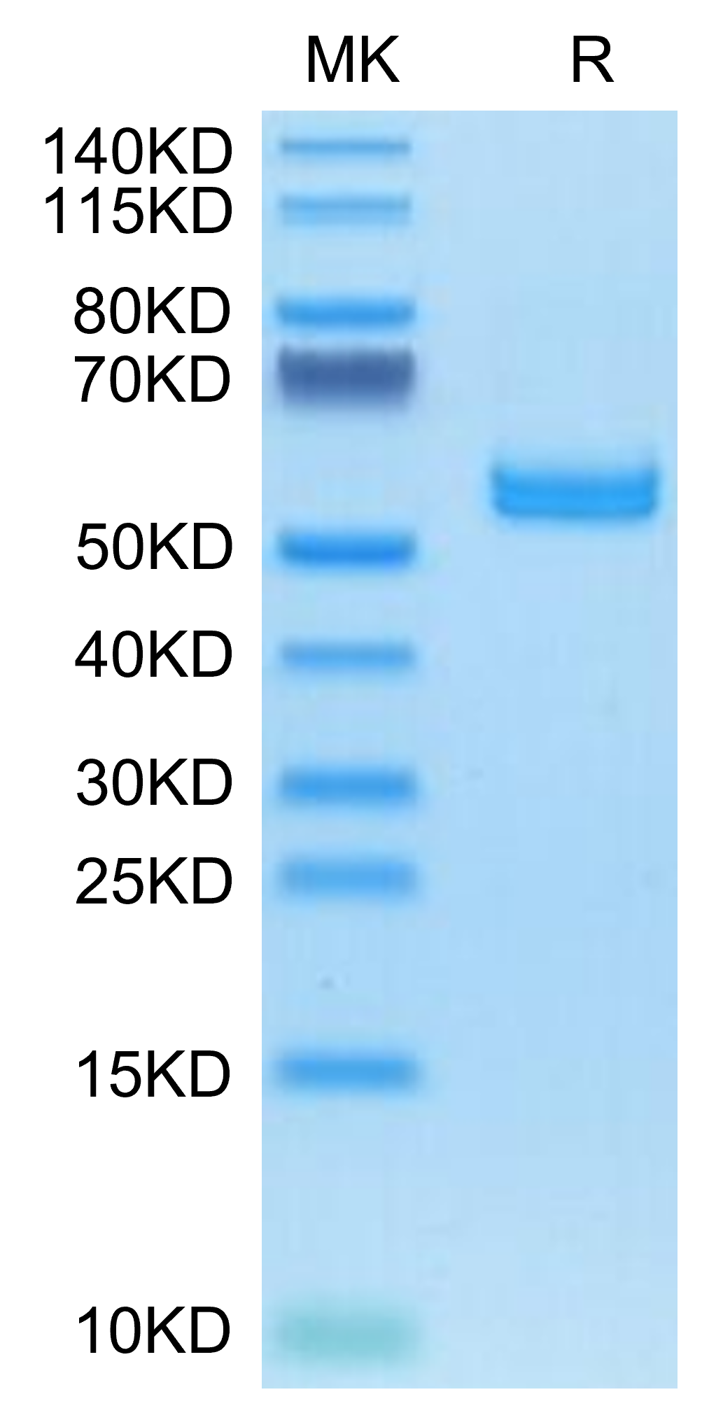 Human AMCase/CHIA Protein, Ultra Low Endotoxin (AMC-HM101-UL)